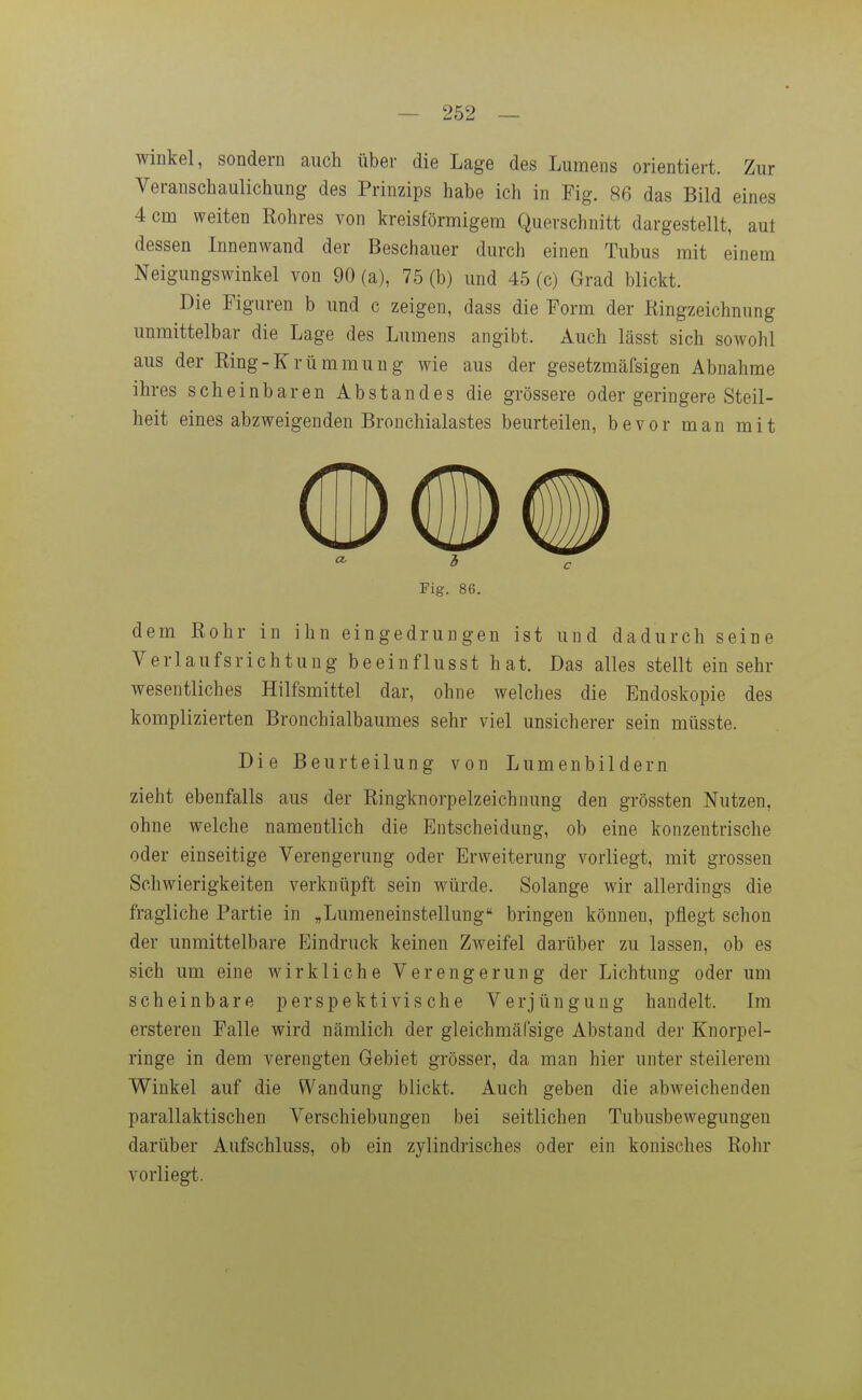Winkel, sondern auch über die Lage des Lumens orientiert. Zur Yeranschaulichung des Prinzips habe ich in Fig. 86 das Bild eines 4 cm weiten Rohres von kreisförmigem Querschnitt dargestellt, aut dessen Innenwand der Beschauer durch einen Tubus mit einem Neigungswinkel von 90 (a), 75 (b) und 45 (c) Grad blickt. Die Figuren b und c zeigen, dass die Form der Ringzeichnung unmittelbar die Lage des Lumens angibt. Auch lässt sich sowohl aus der Ring-Krümmung wie aus der gesetzmäfsigen Abnahme ihres scheinbaren Abstandes die grössere oder geringere Steil- heit eines abzweigenden Bronchialastes beurteilen, bevor man mit Fig. 86. dem Rohr in ihn eingedrungen ist und dadurch seine Verlaufsrichtung beeinflusst hat. Das alles stellt einsehr wesentliches Hilfsmittel dar, ohne welches die Endoskopie des komplizierten Bronchialbaumes sehr viel unsicherer sein müsste. Die Beurteilung von Lumenbildern zieht ebenfalls aus der Ringknorpelzeichnung den grössten Nutzen, ohne welclie namentlich die Entscheidung, ob eine konzentrische oder einseitige Verengerung oder Erweiterung vorliegt, mit grossen Schwierigkeiten verknüpft sein würde. Solange wir allerdings die fragliche Partie in „Lumeneinstellung bringen können, pflegt schon der unmittelbare Eindruck keinen Zweifel darüber zu lassen, ob es sich um eine wirkliche Verengerung der Lichtung oder um scheinbare perspektivische Verjüngung handelt. Im ersteren Falle wird nämlich der gleichmäfsige Abstand der Knorpel- ringe in dem verengten Gebiet grösser, da man hier unter steilerem Winkel auf die Wandung blickt. Auch geben die abweichenden parallaktischen Verschiebungen bei seitlichen Tubusbewegungen darüber Aufschluss, ob ein zylindrisches oder ein konisches Rohr vorliegt.
