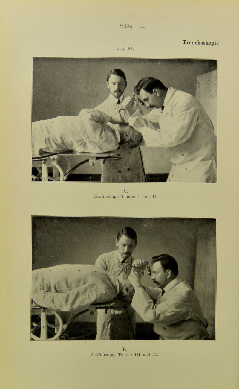 15. Einfülirung: Tempo TU und IV.