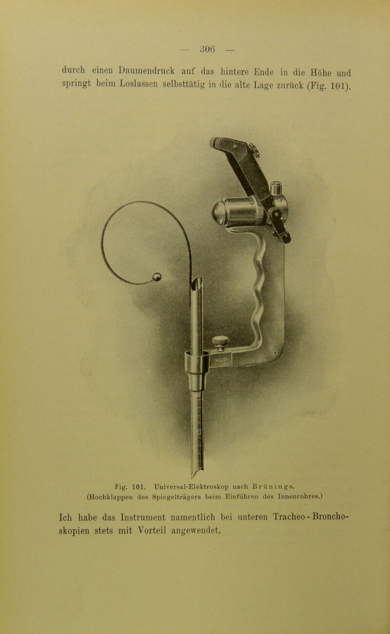durch einen Daiimendmck auf das hintere Ende in die Höhe und springt beim Loslassen selbsttätig in die alte Lage zurück (Fig. 101). Fig. 101. Universal-Elektroskop nach Brünings. (Hochklappen des Spiegelträgers beim Einführen des Innenrohres.) Ich habe das Instrument namentlich bei unteren Tracheo - Broncho- skopien stets mit Vorteil angewendet.
