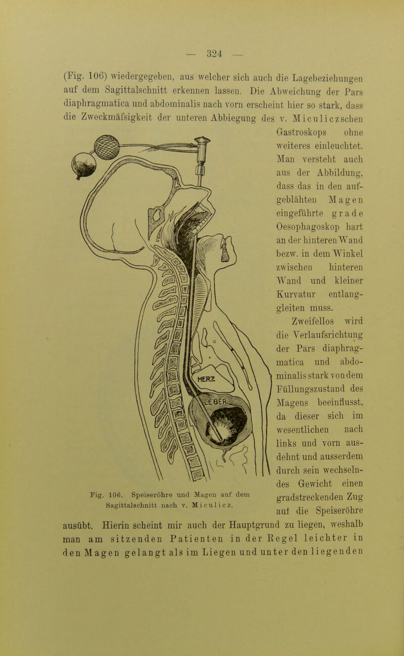 (Fig. 106) wiedergegeben, aus welcher sich auch die Lagebeziehuiigen auf dem Sagittalschiiitt erkennen lassen. Die Abweichung der Pars diaphragmatica und abdominalis nach vorn erscheint hier so stark, dass die Zweckmäfsigkeit der unteren Abbieguug des v. Miculiczscheu Gastroskops ohne weiteres einleuchtet. Man versteht auch aus der Abbildung, dass das in den auf- geblähten Magen eingeführte grade Oesophagoskop hart an der hinteren Wand hezw. in dem Winkel zwischen hinteren Wand und kleiner Kurvatur entlang- gieiten muss. Zweifellos wird die Verlaufsrichtung der Pars diaphrag- matica und abdo- minalis stark von dem Füllungszustand des beeinflusst, dieser sich im Magens da 1 wesentlichen nach links und vorn aus- dehnt und ausserdem durch sein wechseln- des Gewicht einen gradstreckenden Zug auf die Speiseröhre ausübt. Hierin scheint mir auch der Hauptgrund zu liegen, weshalb man am sitzenden Patienten in der Eegel leichter in den Magen gelangt als im Liegen und unter den liegenden Fig. 106. Speiseröhre und Magen auf dem Sagittalschnitt nach v. Miculicz.