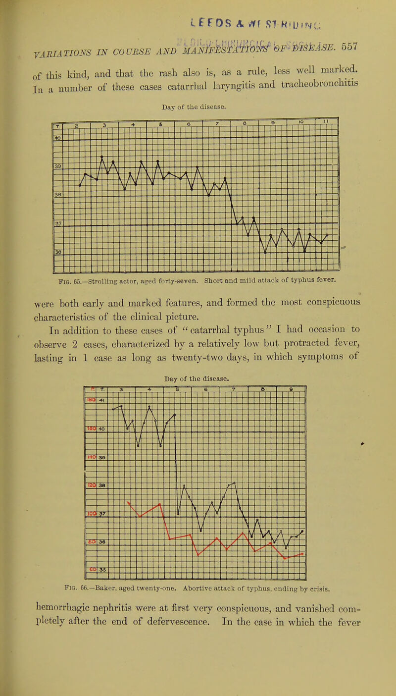 of this kind, and that the rash also is, as a rule, less well marked. In a number of these cases catarrhal laryngitis and tracheobronchitis Day of the disease. Fig. 65.—Strolling actor, aged forty-aeTen. Short and mild attack of typhus fever. were both early and marked features, and formed the most conspicuous, characteristics of the clinical picture. In addition to these cases of  catarrlial typhus  I had occasion to observe 2 cases, characterized by a relatively low but protracted fever, lasting in 1 case as long as twenty-two days, in which symptoms of Day of the disease. -t. 3 4 1 7 t i > •41 i«a to A f -\ i---- 39 15(3 38 1/ r- 37 /- \- 7 tr, 36 -^ y- -A \. V to 33 --+- H -f- 1-- -r- Fig. 06.—Baker, aged twenty-one. Abortive attack of typhus, ending by crisis. hemorrhagic nephritis were at first very conspicuous, and vanished com- pletely after the end of defervescence. In the case in which the fever