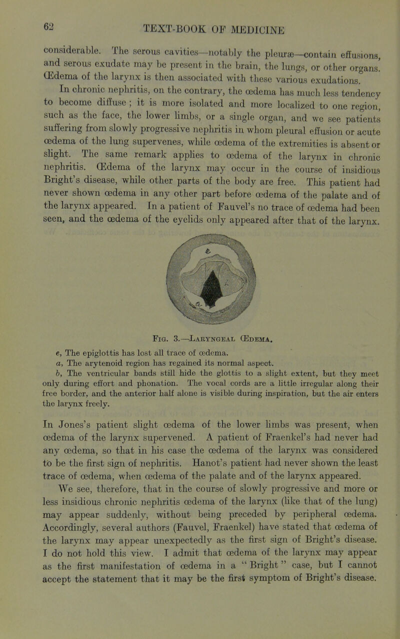 considerable. The serous cavities—notably the pleurae—contain effusions, and serous exudate may be present in the brain, the lungs, or other organs! Oedema of the larynx is then associated with these various exudations. In chronic nephritis, on the contrary, the oedema has much less tendency to become diffuse ; it is more isolated and more locaHzed to one region, such as the face, the lower hmbs, or a single organ, and we see patients sufl'ering from slowly progressive nephritis in whom pleural effusion or acute oedema of the lung supervenes, while oedema of the extremities is absent or slight. The same remark appUes to oedema of the larynx in chronic nephritis. Oedema of the larynx may occur in the course of insidious Bright's disease, while other parts of the body are free. This patient had never shown oedema in any other part before oedema of the palate and of the larynx appeared. In a patient of Fauvel's no trace of 03dema had been seen, and the oedema of the eyelids only appeared after that of the larynx. Fig. 3.—Laryngeal (Edema. e, The epiglottis has lost all trace of oedema. a, The arytenoid region has regained its normal aspect. b, The ventricular bands still hide the glottis to a slight extent, but they meet only during effort and phonation. The vocal cords are a little irregular along their free border, and the anterior half alone is visible during inspiration, but the air enters the larynx freely. In Jones's patient sUght oedema of the lower Hmbs was present, when oedema of the larynx supervened. A patient of Fraenkel's had never had any oedema, so that in his case the oedema of the larynx was considered to be the first sign of nephritis. Hanot's patient had never shown the least trace of oedema, when oedema of the palate and of the larynx appeared. We see, therefore, that in the course of slowly progressive and more or less insidious chronic nephritis oedema of the larynx (like that of the lung) may appear suddenly, without being preceded by peripheral oedema. Accordingly, several authors (Fauvel, Fraenkel) have stated that oedema of the larynx may appear unexpectedly as the first sign of Bright's disease. I do not hold this view. I admit that oedema of the larynx may appear as the first manifestation of oedema in a Bright case, but I cannot accept the statement that it may be the first symptom of Bright's disease.