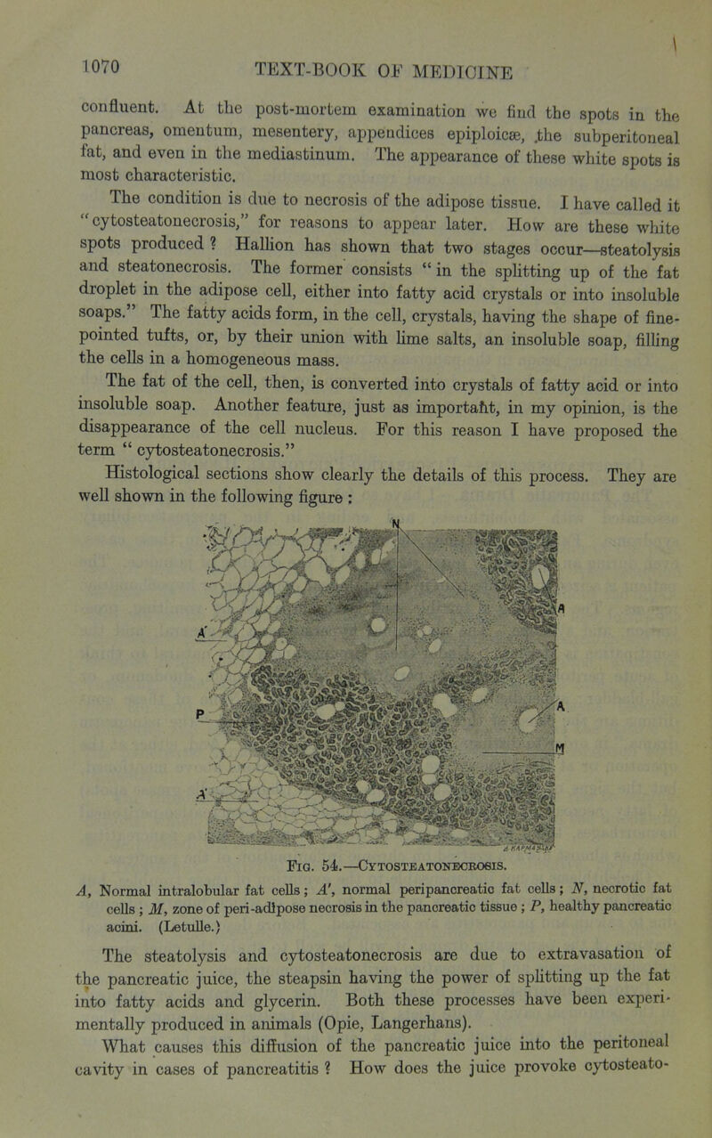 \ confluent. At the post-mortem examination we find the spots in the pancreas, omentum, mesentery, appendices epiploicee, .the subperitoneal fat, and even in the mediastinum. The appearance of these white spots is most characteristic. The condition is due to necrosis of the adipose tissue. I have called it  cytosteatonecrosis, for reasons to appear later. How are these white spots produced ? HaUion has shown that two stages occur—steatolysis and steatonecrosis. The former' consists  in the sphtting up of the fat droplet in the adipose cell, either into fatty acid crystals or into insoluble soaps. The fatty acids form, in the cell, crystals, having the shape of fine- pointed tufts, or, by their union with Hme salts, an insoluble soap, filling the cells in a homogeneous mass. The fat of the cell, then, is converted into crystals of fatty acid or into insoluble soap. Another feature, just as importaht, in my opinion, is the disappearance of the cell nucleus. For this reason I have proposed the term  cytosteatonecrosis. Histological sections show clearly the details of this process. They are well shown in the following figure : Fig. 54.—CYTOSTEATONECBOeiS. A, Normal intralobular fat cells; A', normal peripancreatic fat cells; N, necrotic fat cells; M, zone of peri-adipose necrosis in the pancreatic tissue; P, healthy pancreatic acini. (LetuUe.) The steatolysis and cytosteatonecrosis are due to extravasation of the pancreatic juice, the steapsin having the power of sphtting up the fat into fatty acids and glycerin. Both these processes have been experi- mentally produced in animals (Opie, Langerhans). What causes this diffusion of the pancreatic juice into the peritoneal cavity in cases of pancreatitis ? How does the juice provoke cytosteato-