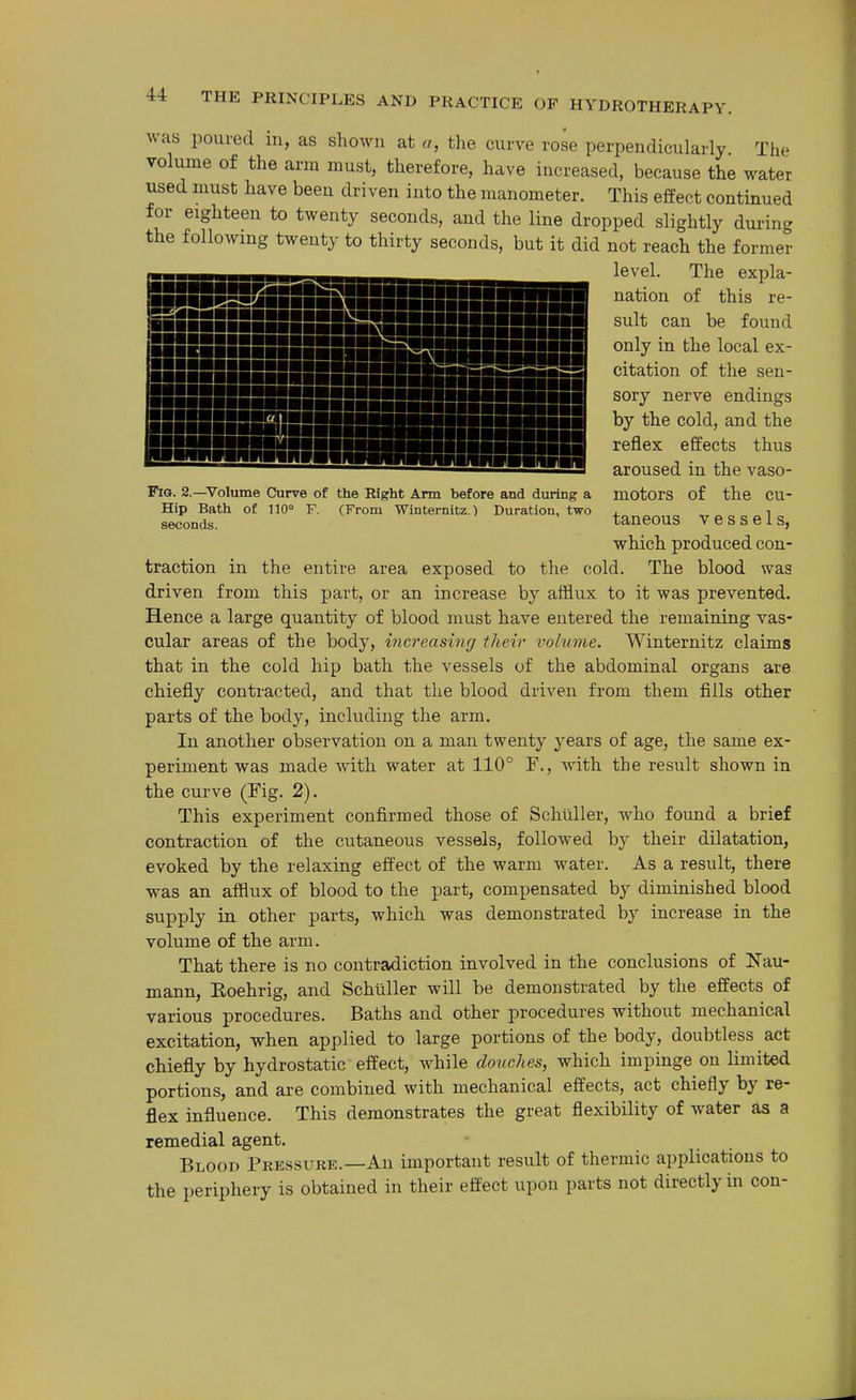 Fig. 2.—Volume Curve of the Right Arm before and during a Hip Bath of 110° F. (From Winternitz.) Duration, two seconds. was poured in, as shown at u, the curve rose perpendicularly The volume of the arm must, therefore, have increased, because the water used must have been driven into the manometer. This effect continued for eighteen to twenty seconds, and the line dropped slightly during the following twenty to thirty seconds, but it did not reach the former level. The expla- nation of this re- sult can be found only in the local ex- citation of the sen- sory nerve endings by the cold, and the reflex effects thus aroused in the vaso- motors of the cu- taneous vessels, which produced con- traction in the entire area exposed to the cold. The blood was driven from this part, or an increase by afiiux to it was prevented. Hence a large quantity of blood must have entered the remaining vas- cular areas of the body, increasing their volume. Winternitz claims that in the cold hip bath the vessels of the abdominal organs are chiefly contracted, and that the blood driven from them fills other parts of the body, including the arm. In another observation on a man twenty years of age, the same ex- periment was made with water at 110° F., with the result shown in the curve (Fig. 2). This experiment confirmed those of Schliller, who found a brief contraction of the cutaneous vessels, followed by their dilatation, evoked by the relaxing effect of the warm water. As a result, there was an afflux of blood to the part, compensated by diminished blood supply in other parts, which was demonstrated by increase in the volume of the arm. That there is no contradiction involved in the conclusions of Nau- mann, Eoehrig, and Schiiller will be demonstrated by the effects of various procedures. Baths and other procedures without mechanical excitation, when applied to large portions of the body, doubtless act chiefly by hydrostatic effect, while douches, which impinge on limited portions, and are combined with mechanical effects, act chiefly by re- flex influence. This demonstrates the great flexibility of water as a remedial agent. Blood Pressure.—An important result of thermic applications to the periphery is obtained in their effect upon parts not directly in con-