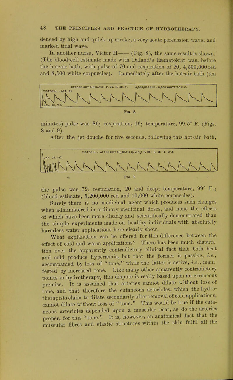 denced by high and quick up stroke, a very acute percussion wave, and marked tidal wave. In another nurse, Victor H (Fig- 8), the same result is shown. (The blood-cell estimate made with Daland's haematokrit was, before the hot-air bath, with pulse of 70 and respiration of 20, 4,500,000 red and-8,500 white corpuscles). Immediately after the hot-air bath (ten BEFORE HOT AIR BAXH - P. 70. R. 20. T. 4j600,000 RED - 8,BOO WHITE TO C. C. VICTOR H. ->ETj 81 JAN. 28, '97. Fig. 8. minutes) pulse was 86; respiration, 16; temperature, 99.5° F. (Figs. 8 and 9). After the jet douche for five seconds, following this hot-air bath. VICTOR H;^ AFTER.HOT AlflBATH ^5 MINJ P. 88- R. 18-T. 99.6 Fic. 9. the pulse was 72; respiration, 20 and deep; temperature, 99° F.; (blood estimate, 5,200,000 red and 10,000 white corpuscles). Surely there is no medicinal agent which produces such changes when administered in ordinary medicinal doses, and none the effects of which have been more clearly and scientifically demonstrated than the simple experiments made on healthy individuals with absolutely harmless water applications here clearly show. What explanation can be offered for this difference between the effect of cold and warm applications? There has been much disputa- tion over the apparently contradictory clinical fact that both heat and cold produce hypersemia, but that the former is passive, i.e., accompanied by loss of tone, while the latter is active, i.e., mani- fested by increased tone. Like many other apparently contradictory points in hydrotherapy, this dispute is really based upon an erroneous premise. It is assumed that arteries cannot dilate without loss of tone, and that therefore the cutaneous arterioles, which the hydro- therapists claim to dilate secondarily after removal of cold applications, cannot dilate without loss of  tone. This would be true if the cuta- neous arterioles depended upon a muscular coat, as do the arteries proper, for this tone. It is, however, an anatomical fact that the muscular fibres and elastic structures within the skin fulfil all the