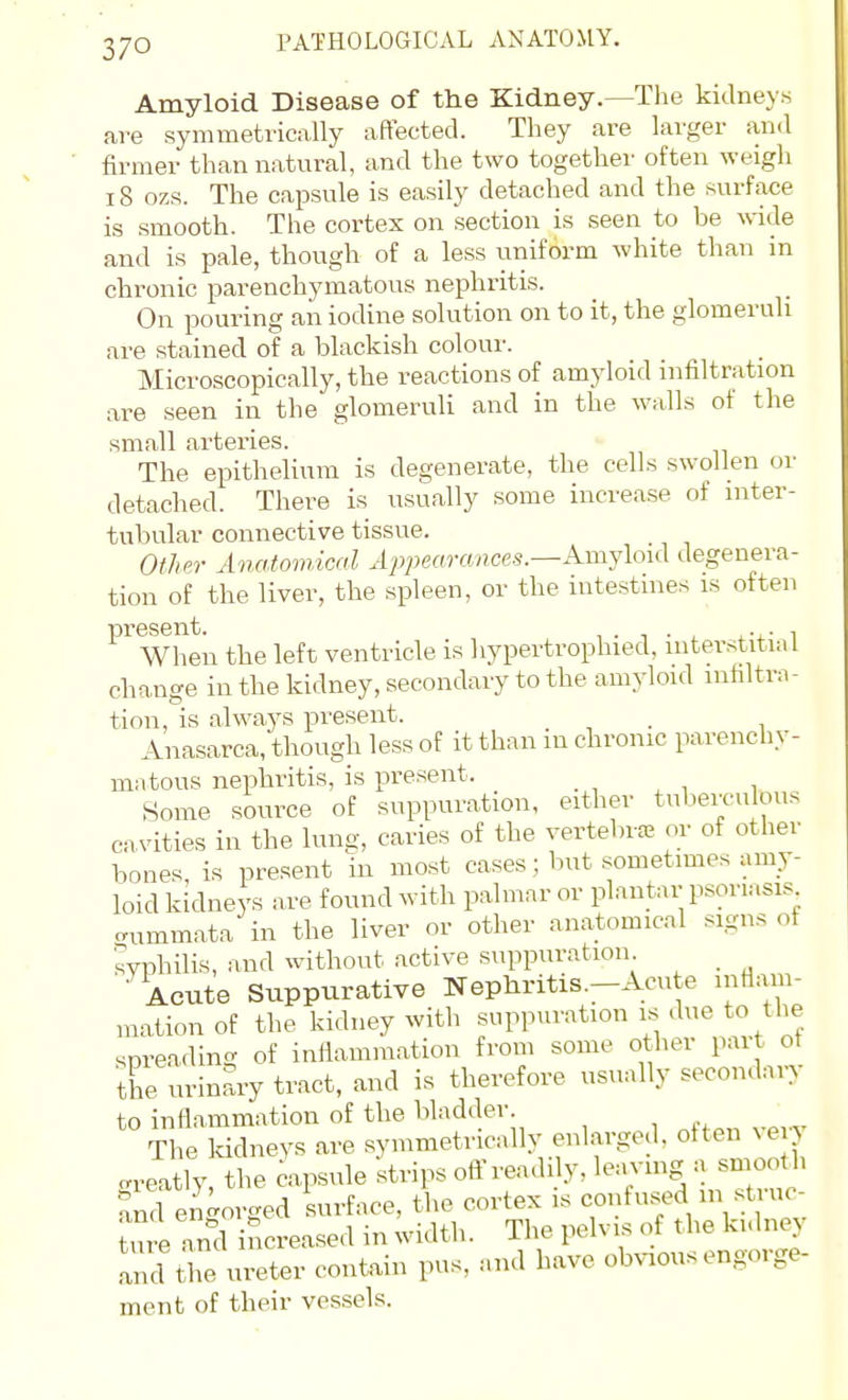 Amyloid Disease of the Kidney.—The kidney.s ave symmetrically affected. They are larger and firmer than natural, and the two togethei' often weigh 18 ozs. The capsule is easily detached and the surface is smooth. The cortex on section is seen to be wide and is pale, though of a less uniform white than in chronic parenchymatous nephritis. On pouring an iodine solution on to it, the glomeruli are stained of a blackish colour. Microscopically, the reactions of amyloid infiltration are .seen in the glomeruli and in the walls of the small arteries. The epithehum is degenerate, the cells swollen or detached. There is usually .some increase of mter- tubular connective tissue. Other Anatomical Appearances.—Amyloid degenera- tion of the liver, the spleen, or the intestines is often When the left ventricle is hypertrophied, interstitial change in the kidney, secondary to the amyloid infiltra- tion, is always present. _ Anasarca, though less of it than m chronic parenchy- matous nephritis, is present. Some source of suppuration, either tuberculous cavities in the luns, caries of the vertebrte or of other bones is present in most cases; but sometimes amy- loid kidneys are found with palmar or plantar psoriasis aummata in the liver or other anatomical signs of syphilis, and without active suppuration _ Acute Suppurative Nephritis.-Acute inflam- mation of the kidney with suppuration is due to the spreading of infiammation from some other part ot the urinary tract, and is therefore usually secondaiy to inflammation of the bladder. The kidneys are symmetrically enlarged, often very gritly, the capsule ktvips off readily, leaving a s^^^^^^ and engorged surface, the cortex is confused in stiuc- ture and increased in width. The pelvis of the kulney IncUhe ureter contain pus, and have obvious engorge- ment of their vessels.