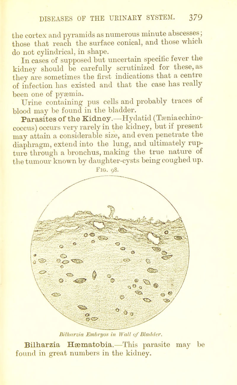 the cortex and pyramids as numerous minute abscesses; those that reach the surface conical, and those which do not cyUndrical, in shape. In cases of supposed but uncertain specihc fever the kidney should be carefully scrvitinized for these, as they are sometimes the first indications that a centre of infection has existed and that the case has really been one of pyemia. Urine containing pus cells and probably traces of blood may be found in the bladder. Parasites of the Kidney.—Hydatid (TaBniaechino- coccus) occurs very I'arely in the kidney, but if present may attain a considerable size, and even penetrate the diaphragm, extend into the lung, and ultimately rup- ture through a bronchus, making the true natm-e of the tumour known by daughter-cysts being coughed up. Fig. 98. liilUtirzin EmbryoK hi H all of Bladilar. Bilharzia Hsematobia.—This pai-asite may be found in great numbers in the kidney.