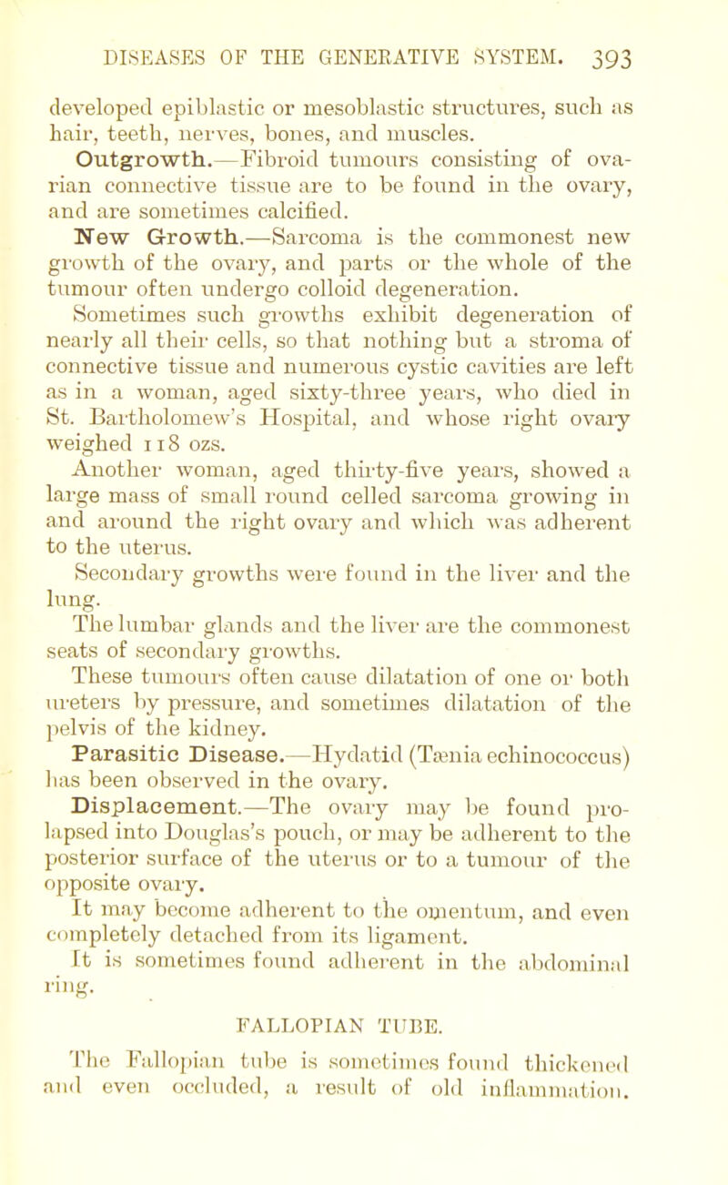 developed epiblastic or mesoblastic structiires, sucli as hair, teeth, nerves, bones, and muscles. Outgrowth.—Fibroid tumours consisting of ova- rian connective tissue are to be found in the ovary, and are sometimes calcified. New Growth.—Sarcoma is the commonest new growth of the ovary, and parts or the whole of the tumour often undergo colloid degeneration. Sometimes such growths exhibit degeneration of nearly all their cells, so that nothing but a stroma of connective tissue and numerous cystic cavities are left as in a woman, aged sixty-three years, who died in St. Bai'tholomew's Hospital, and whose right ovaiy weighed 118 ozs. Another woman, aged thu-ty-five years, showed a large mass of small round celled sarcoma growing in and around the right ovary and which was adherent to the uterus. Secondary growths were found in the liver and the lung. The lumbar glands and the liver are the commonest seats of secondary gi'owths. These tumours often cause dilatation of one oi' both ui'eters by pressure, and sometimes dilatation of the pelvis of the kidney. Parasitic Disease.—Hydatid (Taenia echinococcus) has been observed in the ovary. Displacement.—The ovary may he found pro- lapsed into Douglas's pouch, or may be adherent to the posterior surface of the uterus or to a tumour of the opposite ovaiy. It may become adherent to the omentum, and even completely detached from its ligament. It is sometimes found adherent in the abdominal ring. FALLOPIAN TUBE. The Fallopian tube is sometimes found thickened and even occluded, a result of old inflammation.