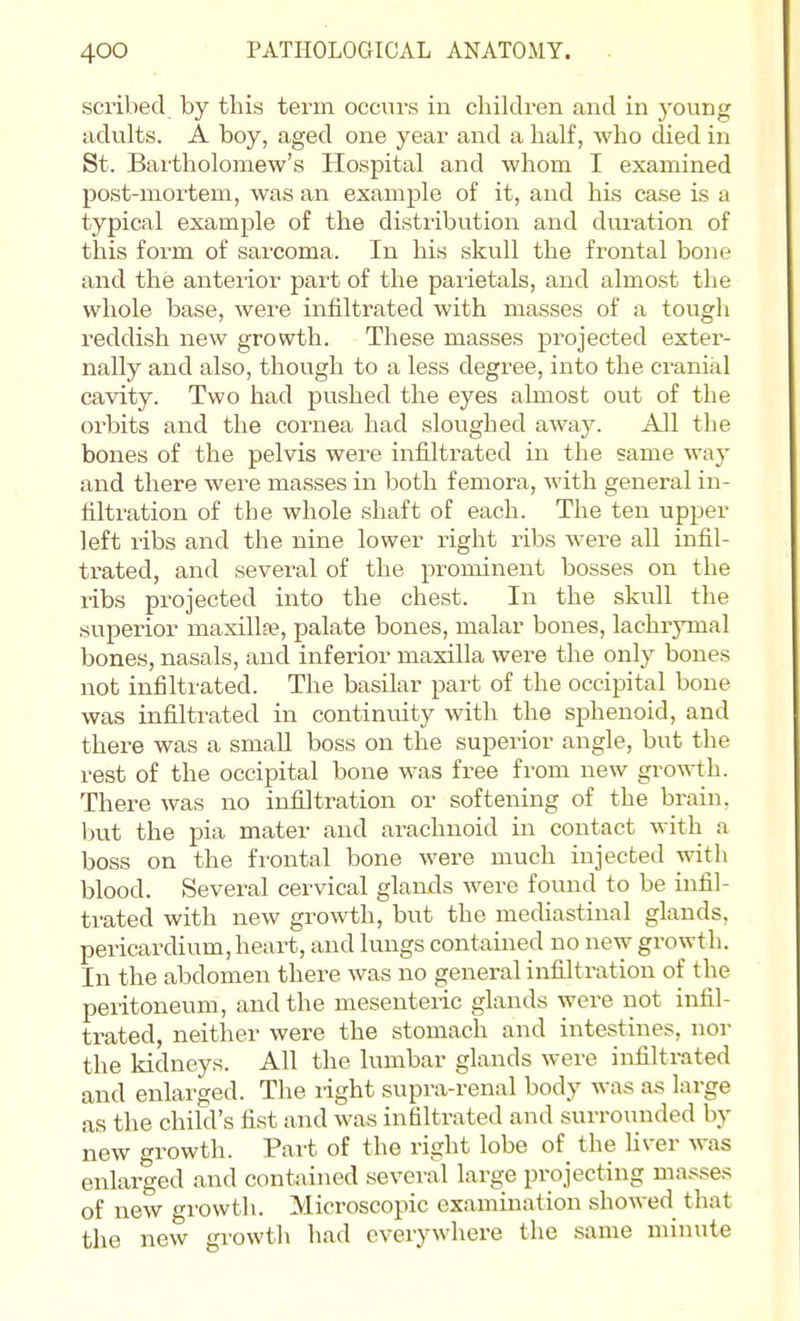 scribed by this tei'in occurs in children and in young adults. A boy, aged one year and a half, who died in St. Bartholomew's Hospital and whom I examined post-mortem, was an example of it, and his case is a typical example of the distribution and duration of this form of sai'coma. In his skull the frontal bone and the anterior part of the parietals, and almost the whole base, wei'e infiltrated with masses of a tougli reddish new growth. These masses projected exter- nally and also, though to a less degree, into the cranial cavity. Two had pushed the eyes almost out of the orbits and the cornea had sloughed away. All the bones of the pelvis were infiltrated in the same way and there were masses in both femora, with general in- filtration of the whole shaft of each. The ten upper left ribs and the nine lower right ribs were all infil- trated, and several of the prominent bosses on the ribs projected into the chest. In the skull the superior maxilla?, palate bones, malar bones, lachrymal bones, nasals, and inferior maxilla were the only bones not infilti'ated. The basilar part of the occipital bone was infiltrated in continuity with the sphenoid, and there was a small boss on the superior angle, but the rest of the occipital bone was free from new gro\^i:h. There was no infiltration or softening of the brain, but the pia mater and arachnoid in contact with a boss on the frontal bone were much injected with blood. Several cervical glands were found to be infil- trated with new growth, but the mediastinal glands, pericardium, heart, and lungs contained no new growth. In the abdomen there was no general infiltration of the pentoneum, and the mesenteric glands were not infil- trated, neither were the stomach and intestines, nor the kidneys. All the lumbar glands were infiltrated and enlarged. The right supra-renal body was as large as the child's fist and was infiltrated and surrovnided by new growth. Part of the right lobe of the liver Avas enlarged and contained several large projecting masses of new growtli. Microscopic examination showed that the new growth had everywhere the same minute