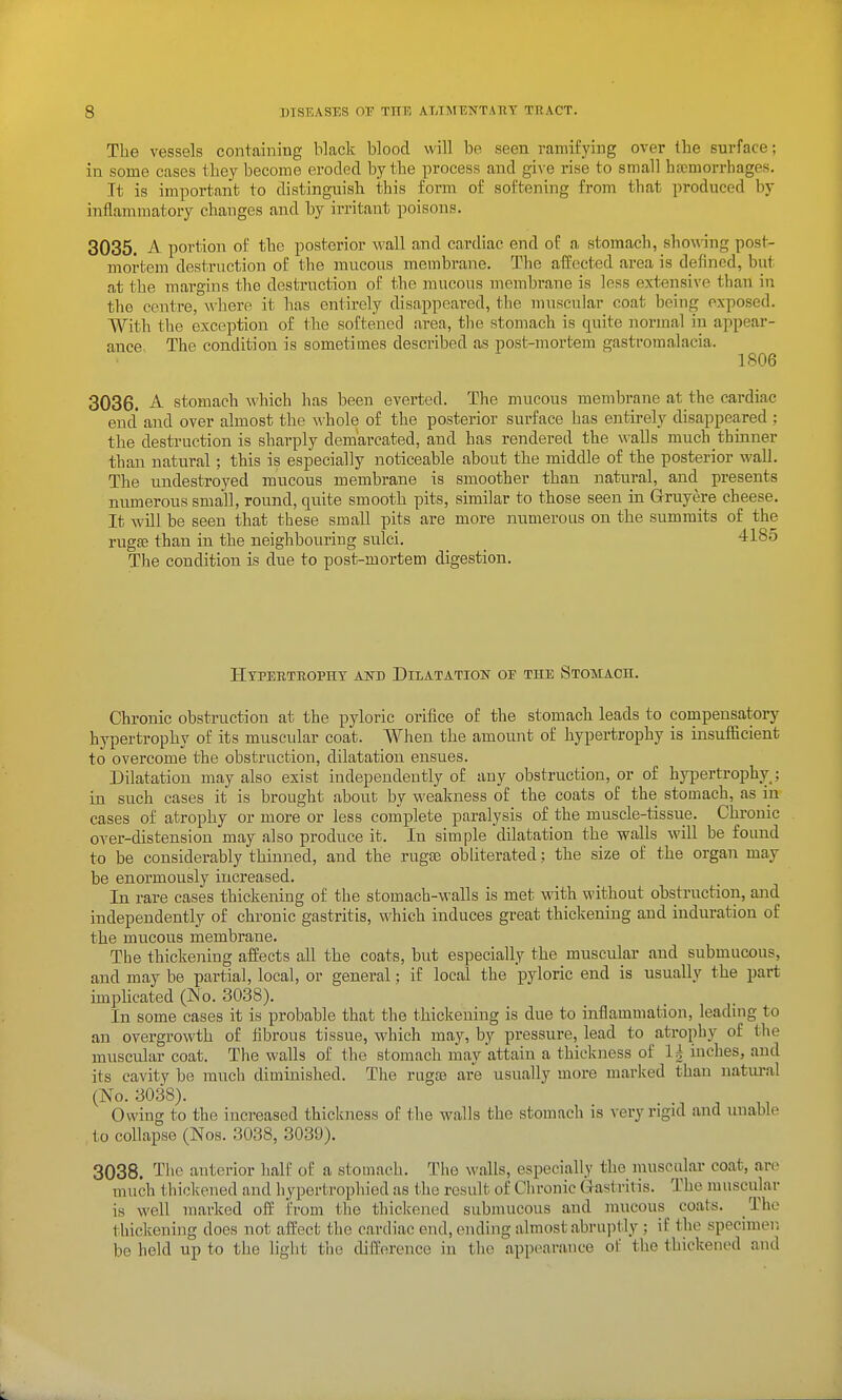 The vessels containing black blood will be seen ramifying over the surface; in some cases they become eroded by the process and give rise to small ba;morrhages. It is important to distinguish this form of softening from that produced by inflammatory changes and by irritant poisons. 3035. A portion of the posterior wall and cardiac end of a stomach, shoA\-ing post- mortem destruction of the mucous membrane. The aff(!cted area is defined, but at the margins the destruction of the mucous membrane is less extensive than in the centre, where it has entirely disappeared, the muscular coat being exposed. With the exception of the softened area, the stomach is quite normal in appear- ance The condition is sometimes described as post-mortem gastromalacia. 1806 3036. A. stomach Mhich has been everted. The mucous membrane at the cardiac end' and over almost the whole of the posterior surface has entirely disappeared ; the destruction is sharply demarcated, and has rendered the \^'alls much thinner than natural ; this is especially noticeable about the middle of the posterior wall. The undestroyed mucous membrane is smoother than natural, and presents numerous small, round, quite smooth pits, similar to those seen in G-ruyere cheese. It will be seen that these small pits are more numerous on the summits of the rugffi than in the neighbouring sulci. 4185 The condition is due to post-mortem digestion. Hypertropht and Dilatation oe the Stomach. Chronic obstruction at the pyloric orifice of the stomach leads to compensatory hypertrophy of its muscular coat. When the amount of hypertrophy is insufficient to overcome the obstruction, dilatation ensues. Dilatation may also exist hidepeudeutly of any obstruction, or of hypertrophy ; in such cases it is brought about by weakness of the coats of the stomach, as in cases of atrophy or more or less complete paralysis of the muscle-tissue. Chronic over-distension may also produce it. In simple dilatation the walls will be found to be considerably thinned, and the rugae obliterated; the size of the organ may be enormously increased. In rare cases thickening of the stomach-walls is met M'ith without obstruction, and independently of chronic gastritis, which induces great thickening and induration of the mucous membrane. The thickening affects all the coats, but especially the muscular and submucous, and may be partial, local, or general; if local the pyloric end is usually the part implicated (No. 3038). In some cases it is probable that the thickening is due to inflammation, leadnig to an overgrowth of fibrous tissue, which may, by pressure, lead to atrophy of the muscular coat. The walls of the stomach may'attain a thickness of 14 inches, and its cavity be much diminished. The rugte are usually more marked than natural (No. 3038). . Owing to the increased thickness of the walls the stomach is very rigid and unable to collapse (Nos. 3038, 3039). 3038. The anterior half of a stomach. The walls, especially the muscular coat, are much thickened and hypertrophied as the result of Clironic Gastritis. The muscular is well marked off i'rom tlie thiclcened submucous and inucous coats. The thickening does not affect the cardiac end, ending almost abruptly ; if the specimen be held up to the light the dil?erence in the appearance of the thickened and