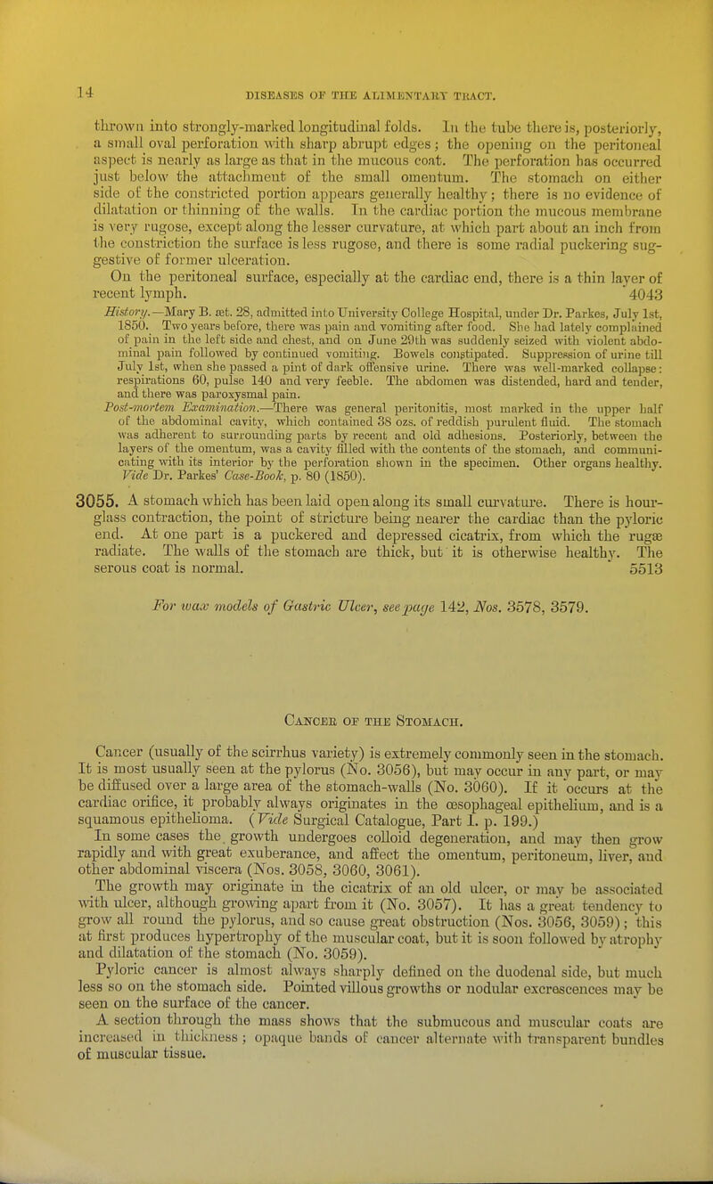 thrown into strongly-marlcecl longitudinal folds, lu the tube there is, posteriorly, II small oval perforation with sharp abrupt edges; the opening on the peritoneal aspect is nearly as large as that in the mucous coat. The perforation has occurred just below the attachment of the small omentum. The stomach on either side of the constricted portion appears generally healthy; there is no evidence of dilatation or thinning of the walls. Tn the cardiac portion the mucous membrane is veiy rugose, except along the lesser curvature, at which part about an inch from the constriction the surface is less rugose, and there is some radial puckering sug- gestive of former ulceration. On the peritoneal surface, especially at the cardiac end, there is a thin layer of recent lymph.  4043 Histori/.—Mary B. set. 28, admitted into University College Hospital, under Dr. Parkes, July 1st, 1850. Two years before, there was pain and vomiting after food. Sbe had lately complained of pain in the left side and chest, and on June 29th was suddenly seized with violent abdo- minal pain followed by continued vomiting. Bowels congtipated. Suppression of urine till July 1st, when she passed a pint of dark ofFensi-ve urine. There was well-marked eoUapse: respirations 60, pulse 140 and very feeble. The abdomen was distended, hard and tender, and there was paroxysmal pain. Post-mortem Examination.—There was general peritonitis, most marked in the upper half of the abdominal cavity, which contained 38 ozs. of reddish purulent iliiid. The stomach was adherent to surrounding parts by recent and old adhesions. Posteriorly, between the layers of the omentum, was a cavity filled with the contents of the stomach, and communi- cating with its interior by the perforation shown in the specimen. Other organs healthy. Vide Dr. Parkes' Case-Boole, p. 80 (1850). 3055. A stomach which has been laid open, along its small curvature. There is hour- glass contraction, the point of stricture being nearer the cardiac than the pyloric end. At one part is a puckered and depressed cicatrix, from which the rugSB radiate. The walls of the stomach are thick, but it is otherwise healthy. The serous coat is normal. 5513 For wax models of Gastric Ulcer, see-page 142, Nos. 3578, 3579. Cancbe op the Stomach. Cancer (usually of the scirrhus variety) is extremely commonly seen in the stomach. It is most usually seen at the pylorus (No. 3056), but may occur in any part, or may be diffused over a large area of the stomach-walls (No. 3060). If it occurs at the cardiac orifice, it probably always originates in the oesophageal epithelium, and is a squamous epithelioma. (Vide Surgical Catalogue, Part 1. p. 199.) In some cases the growth undergoes colloid degeneration, and may then grow rapidly and with great exuberance, and affect the omentum, peritoneum, liver, and other abdominal viscera (Nos. 3058, 3060, 3061). The growth may originate in the cicatrix of an old ulcer, or may be associated with ulcer, although growing apart from it (No. 3057). It has a great tendency to grow all round the pylorus, and so cause gi-eat obstruction (Nos. 3056, 3059); this at first produces hypertrophy of the muscular coat, but it is soon follo\^■ed by atrophy and ddatation of the stomach (No. 3059). Pyloric cancer is almost always sharply defined on the duodenal side, but much less so on the stomach side. Pointed villous growths or nodular excrescences may be seen on the surface of the cancer. A section through the mass shows that the submucous and muscular coats are increased in thickness ; opaque bands of cancer alternate with transparent bundles of mixscular tissue.