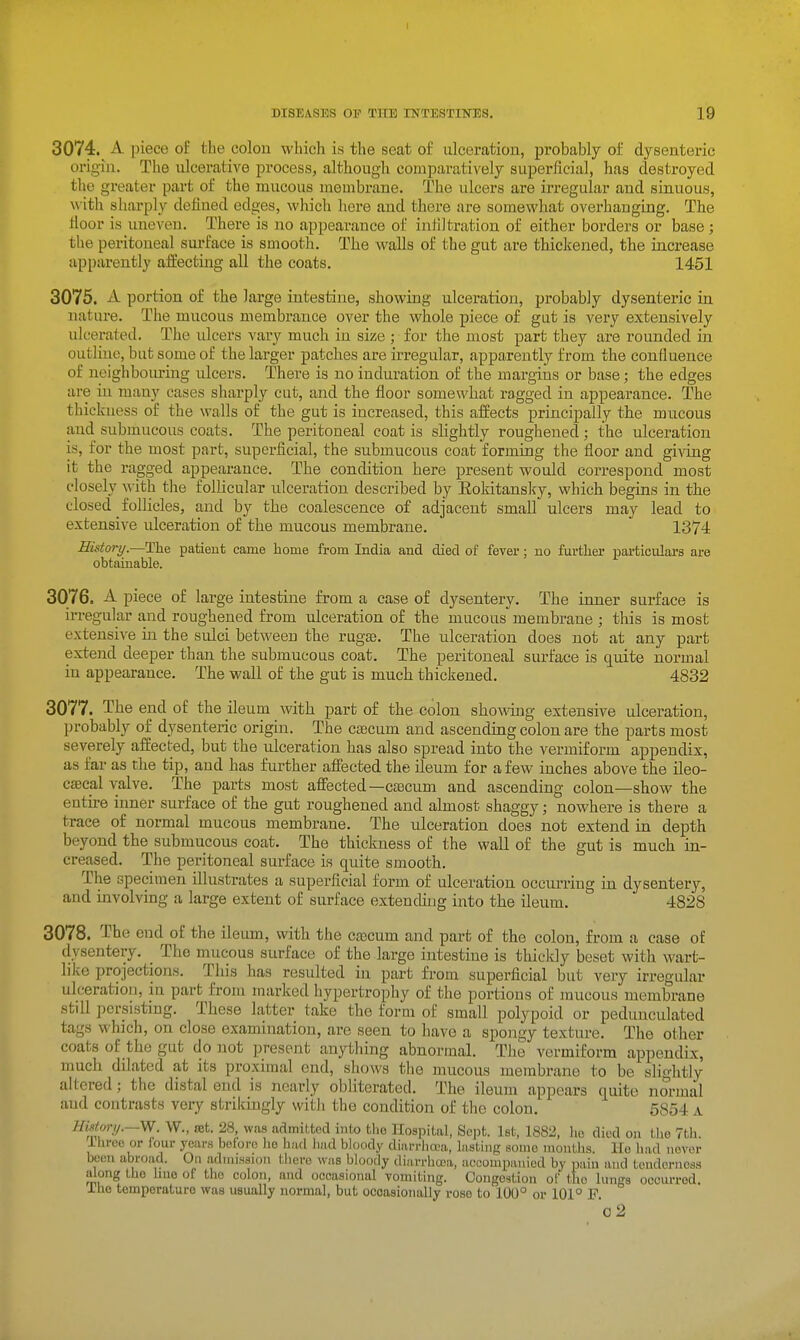 3074. A piece of the colou which is the seat of ulceration, probably of dysenteric origin. The ulcerative process, although comparatively superficial, has destroyed the greater part of the mucous membrane. The ulcers are irregular and sinuous, with sliarply defined edges, which here and there are somewhat overhanging. The fioor is uneven. There is no appearance oi infiltration of either borders or base; the peritoneal surface is smooth. The walls of the gut are thickened, the increase apparently affecting all the coats. 1451 3075. A portion of the large intestine, showing ulceration, probably dysenteric in nature. The mucous membrance over the whole piece of gat is very extensively ulcerated. The ulcers vary much iu size ; for the most part they are rounded iia outline, but some of the larger patches are irregular, apparently from the confluence of neighbouring ulcers. There is no induration of the margins or base; the edges are iu many cases sharply cut, and the floor somewhat ragged in appearance. The thickness of the walls of the gut is increased, this affects principally the mucous and submucous coats. The peritoneal coat is slightly roughened; the ulceration is, for the most part, superficial, the submucous coat forming the floor and giving it the ragged appearance. The condition here present would correspond most closely ^yith the follicular ulceration described by Eokitansky, which begins in the closed follicles, and by the coalescence of adjacent small ulcers may lead to extensive ulceration of the mucous membrane. 1374 History.—The patient came home from India and died of fever; no further particulars are obtainable. 3076. A piece of large intestine from a case of dysentery. The inner surface is irregular and roughened from ulceration of the mucous membrane ; this is most extensive in the sulci between the rugae. The ulceration does not at any part extend deeper than the submucous coat. The peritoneal surface is quite normal in appearance. The wall of the gut is much thickened. 4832 3077. The end of the ileum with part of the colon showng extensive ulceration, probably of dysenteric origin. The caecum and ascending colon are the parts most severely affected, but the ulceration has also spread into the vermiform appendix, as far as the tip, and has further affected the ileum for a few inches above the ileo- caecal valve. The parts most affected—caecum and ascending colon—show the entire inner surface of the gut roughened and almost shaggy; nowhere is there a trace of normal mucous membrane. The ulceration does not extend in depth beyond the submucous coat. The thickness of the wall of the gut is much in- creased. The peritoneal surface is quite smooth. The specimen illustrates a superficial form of ulceration occurring in dysentery, and involving a large extent of surface extending into the ileum. 4828 3078. The end of the ileum, with the cascum and part of the colon, from a case of dysentery. The mucous surface of the large intestine is thickly beset with wart- like projections. This lias resulted in part from superficial but very irregular ulceratjon, ni part from marked hypertrophy of the portions of mucous membrane still ])crsisting. These latter take the form of small polypoid or pedunculated tags which, on close examination, are seen to have a spongy texture. The other coats of the gut do not present anything abnormal. The vermiform appendix, much dilated at its proximal end, shows the mucous membrane to be slightly altered; the distal end is nearly obliterated. The ileum appears quite normal and contrasts very strikingly with the condition of the colon. 5854 a His(ori/.~W. W., ret. 28, was admitted into the Hospital, Sept. Ist, 1882, lie died on tlie 7tli. Ihrce or four years before lie hud had bloody diai-rh(X.'a, lusting some months, lie imd never been abroad. On adnn'ssion there was bloody diarrhoea, accompanied by pain and tenderness along the hue of the colon, and occasional vomiting. Congestion of the lungs occurred. Ihe temperature was usually normal, but occasionally rose to 100° or 101° F. 'o2