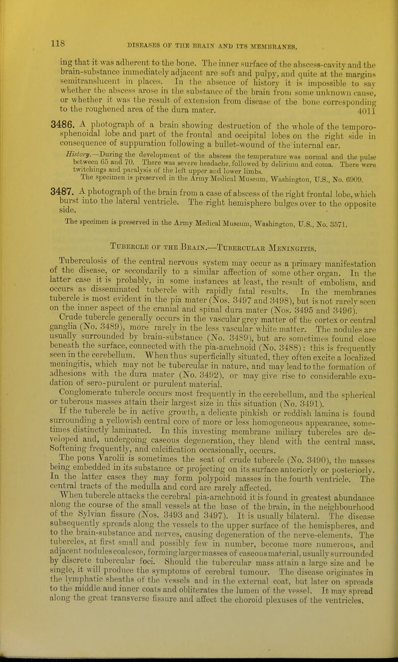 ing that it was adherent to the bone. The inner surface of the abscess-cavity and the brain-substance immediately adjacent are soft and pulpy, and quite at the margins semitranslucent hi places. In the absence of history it is impossible to say whether the abscess arose in the substance of the brain from some unknown cau.se, or whether it was the residfc of extension from disease of the bone corresponding to the I'oughened area of the dura mater. 4011 3486. A photograph of a brain showiug destruction of the whole of the temporo- sphenoidal lobe and part of the frontal and occipital lobes on the right side in consequence of suppuration following a bullet-wound of the internal ear. Hisiory.—Bnrmg the development of the abscess the temperature was normal and the pulse between 65 and /O. There was severe headache, followed by delirium and coma. There were twitchmgs and pai-aljsis of the left upper and lower limbs. The specimen is preserved in the Army Medical Museum, Washington, U.S., No. 6909. 3487. A photograph of the brain from a case of abscess of the right frontal lobe, which burst into the lateral ventricle. The right hemisphere bulges over to the opposite side. The specimen is preserved in the Army Medical Museum, Washington, U.S., No. 3.571. Ttjberoi,e oe the Beain.—Ttjbeectjlae Meningitis. Tuberculosis of the central nervous system may occur as a primary manifestation of the disease, or secondarily to a similar affection of some other organ. In the latter case it is probably, in some instances at least, the result of embohsm, and occurs as disseminated tubercle with rapidly fatal results. In the membranes tubercle is most evident in the pia mater (Nos. 3497 and 3498), but is not rarely seen on the inner aspect of the cranial and spinal dura mater (Nos. 3495 and 3496). Crude tubercle generally occurs in the vascular grey matter of the cortex or central gangha (No. 3489), more rarely in the less vascular white matter. The nodules are usuaUy surrounded by brain-substance (No. 3489), but are sometimes found close beneath the surface, connected with the pia-arachnoid (No. 3488) : this is frequently seen m the cerebeUum. When thus superficiaUy situated, thev often excite a locahzed meningitis, which may not be tubercular in nature, and may'lead to the formation of adhesions with the dura mater (No. 3492), or may give 'rise to considerable exu- dation of sero-purulent or purulent material. Conglomerate tubercle occurs most frequently in the cerebellum, and the spherical or tuberous masses attain their largest size in this situation (No. 3491). If the tubercle be in active growth, a delicate pinkish or reddish lamina is found siirrounding a yellowish central core of more or less homogeneous appearance, some- times distinctly laminated. In this investing membrane miliary tubercles are de- veloped and, undergoing caseous degeneration, they bleud with the central mass. Softening frequently, and calcification occasionallv, occurs. The pons Varolii is sometimes the seat oF crude tubercle (No. 3490), the masses being embedded in its substance or projecting on its surface anteriorly or posteriorly. In the latter cases they may form polypoid masses ha the fourth \-entricle. The central tracts of the medulla and cord are rarely affected. When tubercle attacks the cerebral pia-arachuoid it is found in greatest abundance along the course of the small vessels at the base of the brain, m the neighbouriiood ot the Sylvian fissure (Nos. 3493 and 3497). It is usually bilateral. The disease subsequently spreads along the vessels to the upper surfaceof the hemispheres, and to the bram-substance and nerves, causing degeneration of the nerve-elements. The tubercles, at first small and possibly few in number, become more numerous, and adjacent nodules coalesce, forminglarger masses of caseousmaterial.usuallvsurrounded by discrete tubercular foci. Should Ihe tubercular mass atiain'a large size and be single, it will produce the symptoms of cerebral tumour. The disease originates in the lymphatic sheaths of the vessels and in the external coat, but later on spreads to the middle and inner coats and obliterates the lumen of the vessel. It mav s]nead along the great transverse fissure and affect the choroid plexuses of the ventricles.