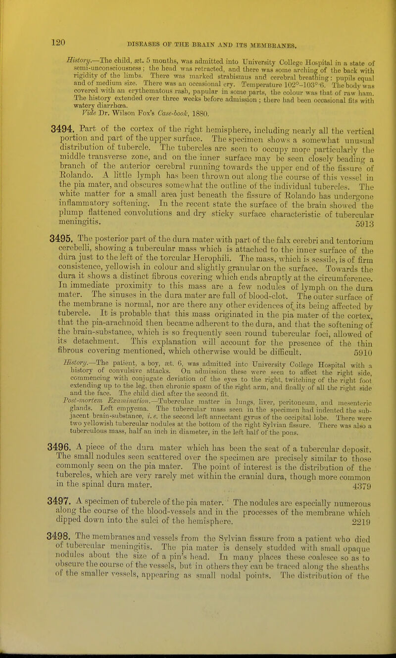 History.—The child, set. 5 monf hs, was admitted into University College Hospital in a state of semi-unconsciousness ; the hond was retracted, and there was some arching of the back with rigidity of the limbs. There was marked strabismus and cerebral breathing: pupils equal and of medium size. There was an occasional cry. Temperature 102°-10;i°-r). The body was covered with an erythematous rash, papular in'some parts, the colour was that of raw ham The history extended over three weeks before admission ; there imd been occasional fits witli watery diarrhoea. Fide Dr. Wilson Fox's Case-book, 1880. 3494. Part of the cortex ol' tlie riglit hemisphere, including nearly all the vertical portion and part of the upper surface. The specimen shows a somewhat unusual distribution of tubercle. The tubercles are seen to occupy more particularly the middle transverse zone, and on the inner surface may be seen closely beading a branch of the anterior cerebral running towards the upper end of the fis.sure of Eolando. A little lymph has been thrown out along the course of this vessel in the pia mater, and obscures somewhat the outhne of the individual tubercles. The white matter for a small area just beneath the fissure of Eolando has undergone inflammatory softening. In the recent state the surface of the brain showed the plump flattened convolutions and dry sticky surface characteristic of tubercular meningitis.  5913 3495. The posterior part of the dura mater with part of the falx cerebri and tentorium cerebelli, showing a tubercular mass which is attached to the inner surface of the diira just to the left of the torcular Herophili. The mass, which is sessile, is of firm consistence, yellowish in colour and slightly granular on the surface. Towards the dura it shows a distinct fibrous covering which ends abruptly at the circumference. In immediate proximity to this mass are a few nodules of lymph on the dura mater. The sinuses in the dam mater are full of blood-clot. The outer surface of the membrane is normal, nor are there any other evidences of its being aiSected by tubercle. It is probable that this mass originated in the pia mater of the cortex, that the pia-arachnoid then became adherent to the dura, and that the softening of the brain-substance, which is so i'requently seen round tubercular foci, allowed of its detachment. This explanation «ill account for the presence of the thin fibrous covering mentioned, which otherwise would be difficult. 5910 Histori/.~The patient, a boy, ret. 6, was admitted into University College Hospital with a history of convulsive attacks. On admission these were seen to afCect the right side, commencing with conjugate deviation of the eyes to the right, twitching of the right foot extending up to the leg, then chronic spasm of the right arm, and finallv of all the right side and the lace. The child died after the second fit. Post-mortem Examination.—Tnb&rc.n\iiv matter in lungs, livei-, peritoneum, and mesenteric glands. Left empyema. The tubercular mass seen in the specimen had indented the sub- jacent brain-substance, i. e. the second left annectfint gyrus of the occipital lobe. There were two yellowish tubercular nodules at the bottoui of the right Sylvian fissure. There was also a tuberculous mass, half an inch in diameter, in the loft half of the pons. 3496. A piece of the dura mater which has been the seat of a tubercular deposit. The small nodules seen scattered over the specimen are precisely similar to those commonly seen on the pia mater. The point of iaterest is the distribution of the tubercles, which are very rarely met within the cranial dura, though more common in the spinal dura mater. 4379 3497. A specimen of tubercle of the pia mater. ' The nodules are especially numerous along the course of the blood-vessels and in the processes of the membrane which cUpped down into the sulci of the hemisphere. 2219 3498. The membranes and vessels from the Sylvian fissm-e from a patient who died of tulDercular meningitis. The pia inator is densely studded with small opaque nodules about tlie size of a pin's head. In many places these coalesce so as to obscure tlie course of the vessels, but in others they can be traced along the sheaths of the smaller vessels, appearing as suiall nodal points. The distribution of the