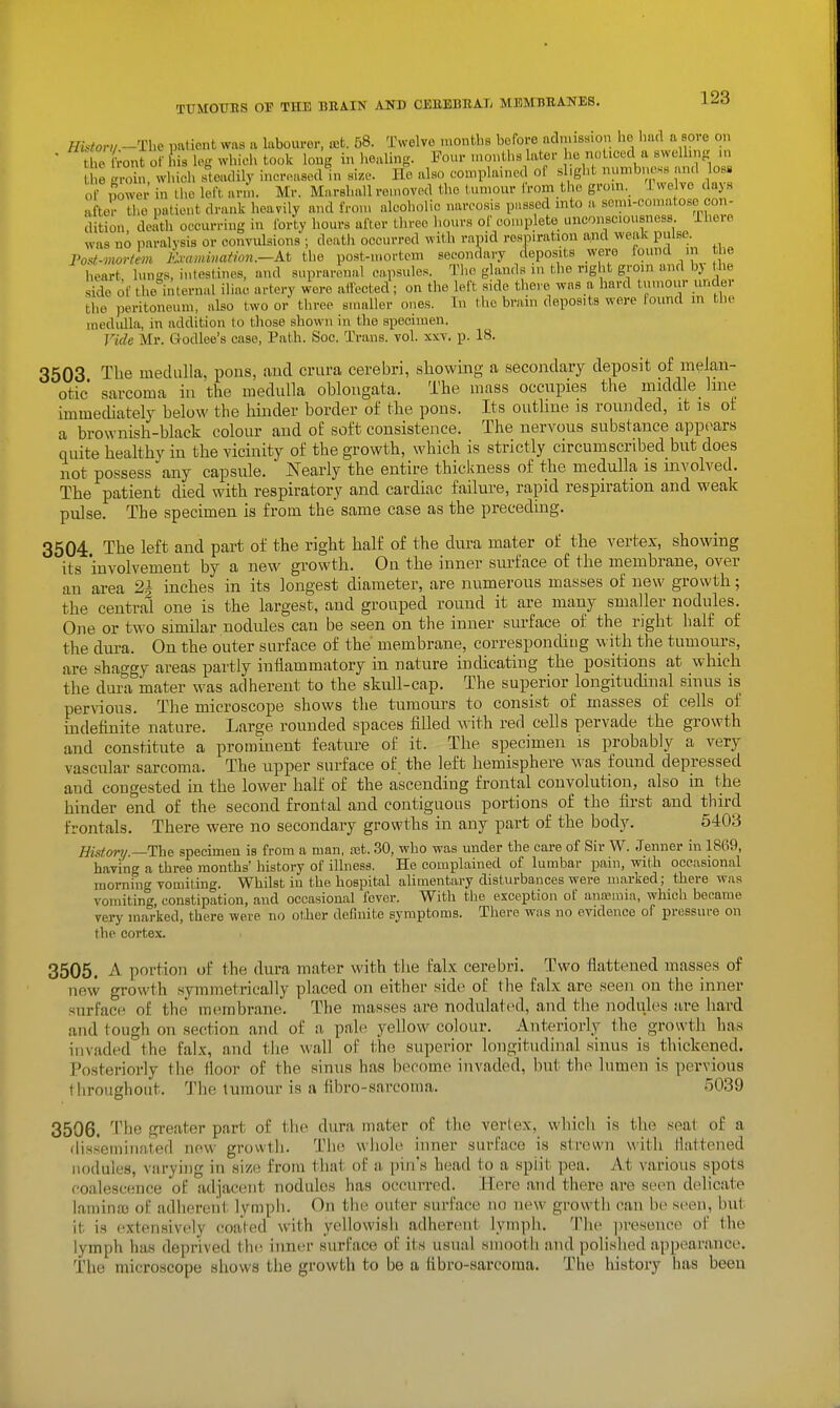 HHorii -The patient was a labourer, at. 58. Twelve monbhs before admiBsion he Imd a sore on • he Lnt o? his log whic-h took long in healing. Four .nonth« later ho noticed a swelling .n e wl.ich .steadily increased in si/.e. He also complained of slight numbncse and loss S ver in the loft arm. Mr. Marshall removed the tumour from the groni. Twelve days LftJr the patient drank heavily and from alcoholic narcosis passed into a semi-comatoso con- dition deith occurring in forty hours after three hours of complete unconsciousness There was no paralysis or convulsions ; deatii occurred with vapid respiration and weak pulse Fod-vwrtem Exammation.-At the post-.uortcm secondary deposits were found in tl e heart lungs, intestines, and suprarenal capsules. The glands in the right groin and bj the side of the internal iliac artery were affected; on the left side there was a hard tumour under the peritoneum, also two or three smaller ones. In the brain deposits were found in the medulla, in addition to tliose shown in the specimen. Vide Mr. Godlee's case, Path. Soc. Trans, vol. xxv. p. 18. 3503 Tlie medulla, pons, and crura cerebri, showing a secondary deijosit of melan- otic sarcoma iu the medulla oblongata. The mass occupies the middle line immecUatelj below the hinder border of the pons. Its outline is rounded, it is ot a brownish-black colour and of soft consistence. The nervous substance appears quite healthy in the vicinity of the growth, which is strictly circumscribed but does not possess any capsule. Nearly the entire thiclcness of the medulla is involved. The patient died with respiratory and cardiac failure, rapid respiration and weak pulse. The specimen is from the same case as the preceding. 3504 The left and part of the right half of the dura mater of the vertex, showing its involvement by a new growth. On the inner surface of the membrane, over an area 2| inches in its longest diameter, are numerous masses of new growth; the central one is the largest, and grouped round it are many smaller nodules. One or two similar nodules can be seen on the inner surface of the right half of the dura. On the outer surface of the membrane, corresponding with the tumours, are shaggy areas partly inflammatory in nature indicating the positions at which the dura inater was adherent to the skull-cap. The superior longitudinal sinus is pervious. The microscope shows the tumours to consist of masses of cells of indefinite nature. Large rounded spaces filled with red cells pervade the growth and constitute a prominent feature of it. The specimen is probably a very vascular sarcoma. The upper surface of. the left hemisphere was found depressed and congested in the lower half of the ascending frontal convolution, also in the hinder end of the second frontal and contiguous portions of the first and third frontals. There were no secondary growths in any part of the body. 5403 Histor)/ —The specimen is from a man, rot. 30, who was under the care of Sir W. Jenner in 1869, having a three months' history of illness. He complained of lumbar pain, with occasional morning vomiting. Whilst in the hospital alimentary disturbances were marked; there was vomiting, constipation, and occasional fever. With the exception of anaunia, which became very marked, there were no otJier definite symptoms. There was no evidence of pressure on the cortex. 3505. A portion of the dura mater with the falx cerebri. Two flattened masses of new growth symmetrically placed on either side of the falx are seen on the inner surface of the membrane. The masses are nodulated, and the nodules tire hard and tough on section and of a pale yellow colour. Anteriorly the growth has invaded the falx, and the wall of the superior longitudinal sinus is thickened. Posteriorly the floor of the sinus has become invaded, but the lumen is pervious throughout. The tumour is a fibro-sarcoma. r)039 3506. The greater part of the dura mater of t;l)c vertex, which is the seat of a (lissemiuated new growth. The wiiole inner surface is strewn with flattened nodules, varying in size from that of a pin's head to a split pea. At various spots coalescence of adjacent nodules has occurred. Here and there are mm delicate lamina) of adherent lytnpli. On the outer surface uo new growth can be seen, but it is extensively coated with yellowish adherent lymph. The i)vesence of the lymph has deprived th(5 inner surface of its usual smooth and polished a])pearance. The microscope shows the growth to be u fibro-sarcoma. The history has been