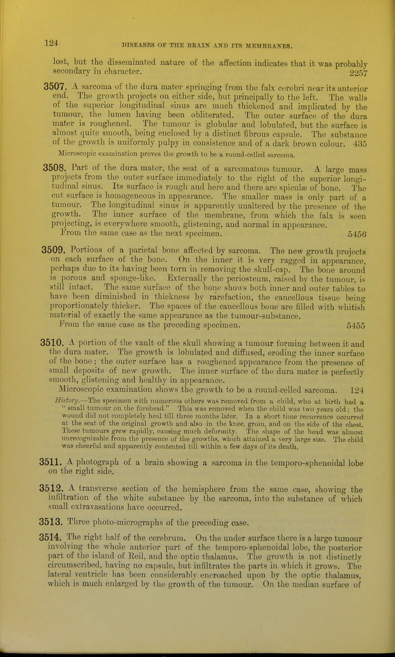 lost, but the disseminated nature of the affection indicates that it was probably secondaiy in character. 2257 3507. A sarcoma of 1 lie dura mator spriuf^ing from tlie falx cerebri near its anterior end. The growth projects on either -side, but principally to the left. The walls of the superior longitudinal sinus are much thickened and implicated by the tumour, the lumen having been obliterated. The outer surface of the dura mater is roughened. The tumour is globular and lobulated, but the surface is almost quite smooth, being enclosed by a distinct fibrous capsule. The substance of the growth is uniformly pulpy in consistence and of a dark brown colour. 435 Microscopic examination proves the growth lo be a round-celled sarcoma. 3508. Part of the dura mater, the seat of a sarcomatous tumour. A large mass projects from the outer surface immediately to the right of the superior longi- tudinal sinus. Its surface is rough and here and there are spiculte of bone. 1'he cut surface is homogeneous in appearance. The smaller mass is only part of a tumour. The longitudinal sinus is apparently unaltered by the presence of the growth. The inner surface of the membrane, from which the falx is seen projecting, is everywhere smooth, glistening, and normal in appearance. Prom the same case as the next specimen. 5456 3509. Portions of a parietal bone affected by sarcoma. The new growth projects on each surface of the bone. On the inner it is very ragged in appearance, perhaps due to its having been torn in removing the skull-cap. The bone aroimd is porous and sponge-Hke. Externally the periosteum, raised by the tumour, is still intact. The same surface of the bone shows both inner and outer tables to have been diminished in thickness by rarefaction, the cancellous tissue being proportionately thicker. The spaces of the cancellous bone are filled with whitish material of exactly the same appearance as the tumour-substance. From the same case as the preceding specimen. 5455 3510. A portion of the vault of the skull showing a tumour forming between it and the dura mater. The growth is lobulated and diffused, eroding the inner surface of the bone; the outer surface has a roughened appearance from the presence of small deposits of new growth. The inner surface of the dura mater is perfectly smooth, glistening and healthy in appearance. Microscopic examination shows the growth to be a round-celled sarcoma. 124 History.—The specimen with numerous others was removed from a child, who at birth had a  small tumour on the forehead. This was removed when the child was two years old; the wound did not completely heal till three months later. In a short time recurrence occurred at the seat of the original growth and also in the knee, groin, and on the side of the chest. These tumours grew rapidly, cansing much deformity. Tlie shape of the head was almost unrecognizable from the presence of the growths, which attained a very large size. The child was cheerful and apparently contented till within a few days of its death. 3511. A photograph of a brain showing a sarcoma in the temporo-sphenoidaJ lobe on the right side. 3512. A transverse section of the hemisphere from the same case, showing the infiltration of the white substance by the sarcoma, into the substance of which small extravasations have occurred. 3513. Three photo-mici'ographs of the preceding case. 3514. The right half of the cerebrum. On tlie under surface thei'e is a large tumour involving the M'hole anterior part of the tempore-sphenoidal lobe, the posterior part of the island of Reil, and the optic thalamus. The growth is not distinctly circumscribed, having no capsule, but infiltrates the parts in which it grows. The lateral ventricle has been considerably encroached upon by the optic thalamus, which is much enlarged by the growth of the tumour. On the median surface of