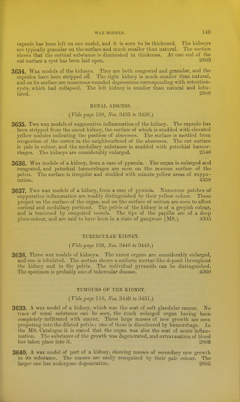 capsule has been left on one model, and it is seen to be tliiekened. The kidneys are typically granular on the surface and much smaller than natural. The section shows that the cortical substance is diminished in thickness. At one end of the cut surface a cyst has beeu laid open. 2803 3634. Wax models of the kidneys. They are both congested and granular, and the capsules have been stripped off. The right kidney is much smaller than natural, and on its surface are numerous rouuded depressions corresponding with retention- cysts, which had collapsed. The left kidney is smaller than natural and lobu- lated. ■ 28U8 EENAL ABSCESS. ■ {Videpage 108, Nos. 3435 to 3438.) 3635. Two wax models of suppurative inflammation of the kidney. The capsule has been stripped from the uncut kidney, the surface of which is studded with elevated yellow nodules indicating the position of abscesses. The surface is mottled from congestion of the cortex in the neighbourhood of the abscesses. The cut surface is pale in colour, and the medullary substance is studded with petechial ha)mor- rhages. The kidneys are considerably enlarged. 2540 3636. Wax models of a kidney, from a case of pysemia. The organ is enlarged and congested, and petechial haemorrhages are seen on the mucous surface of the pelvis. The surface is irregular and studded with minute yellow areas of suppu- ration. 4358 3637. Two wax models of a kidney, from a case of pyaemia. Numerous patches of suppurati\e inflammation are readily distinguished by their yellow colour. These project on the surface of the organ, and on the surface of section are seen to affect cortical and medullary poi'tionS. The pelvis of the kidney is of a greyish colour, and is traversed by congested vessels. 'Ihe tips of the papillas are of a deep plum-colour, and are said to have been in a state of gangrene (MS.). 4335 TUBERCULAE KIDNEY. {Videpcuje 109, Nos. 3440 to 3448.) 3638. Three wax models of kidneyss The uncut organs are considerably enlarged, and one is lobulated. The section shows a uniform mortar-like deposit throughout the kidney and in the pelvis. The individual pyramids can be distinguished. The specimen is probably one of tubercular disease. 4360 TUMOUES OP THE KIDNEY. {Videpage 110, Nos. 3449 to 3451.) 3639. A. wax model of a kidney, which was the seat of soft glandular cancer. No trace of renal substance can be seen, the much enlarged organ having been completely infiltnited with cancer. Three large masses of new growth are seen projecting into the dilated pelvis ; one of these is discoloured by haemorrhage. In the MH. Catalogue it is stated that the organ was also the seat of acute inflam- mation. The substance of the growth was degenerated, and extravasation of blood has taken place into it. 2806 3640. A wax model of part of a kidney, showing masses of secondary new growth in its substance. The masses are easily recognized by their pale colour. The larger orve has undergone degeneration. 2805