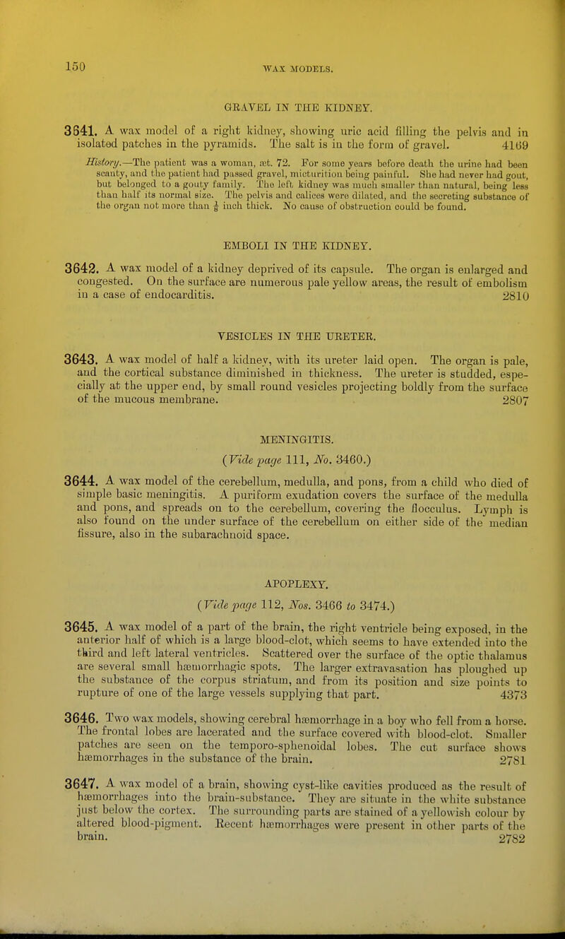 GRAVEL IN THE KIDNEF. 3841. A wax model of a right kidney, sliowing uric acid filling the pelvis and in isolated patches in the pyramids. The salt is in the form of gravel. 4109 Hisiory.—The patient was a woman, ret. 72. For .some years before death the urine had been scanty, and the patient had passed gravel, micturition being painful. She had never had gout, but belonged to a gouty family. The left kidney was mucli smaller than natural, being less than half its normal size. The pelvis and calices were dilated, and the secreting substance of the organ not more than f inch thick. No cause of obstruction could be found. EMBOLI IN THE KIDNEY. 3642. A wax model of a kidney deprived of its capsule. The organ is enlarged and congested. On the surface are numerous pale yellow areas, the result of embolism in a case of endocarditis. 2810 VESICLES IN THE URETEE, 3643. A wax model of half a Iridney, with its ureter laid open. The organ is pale, and the cortical substance diminished in thickness. The ureter is studded, espe- cially at the upper end, by small round vesicles projecting boldly from the surface of the mucous membrane. 2807 MENINGITIS. {Vide iDcige 111, iVb. 3460.) 3644. A wax model of the cerebellum, medulla, and pons, from a child who died of simple basic meningitis. A puriform exudation covers the surface of the medulla and pons, and spreads on to the cerebellum, covering the flocculus. Lymph is also found on the under surface of the cerebellum on either side of the median fissure, also in the subarachnoid space. APOPLEXY. (Videparje 112, Ms. 3466 to 3474.) 3645. A wax model of a part of the brain, the right ventricle being exposed, in the anterior half of which is a large blood-clot, which seems to have extended into the tkird and left lateral ventricles. Scattered over the surface of the optic thalamus are several small hajmorrhagic spots. The larger extravasation has ploughed up the substance of the corpus striatum, and from its position and size points to rupture of one of the large vessels supplying that part. 4373 3646. Two wax models, showing cerebral hemorrhage in a boy who fell from a horse. The frontal lobes are lacerated and the siai'ace covered with blood-clot. Smaller patches are seen on the temporo-sphenoidal lobes. The cut surface shows hsBmorrhages in the substance of the brain. 2781 3647. A wax model of a brain, showing cyst-like cavities produced as the result of hsemorrhages into the brain-substance. They are situate in the white substance just below the cortex. The surrounding parts are stained of a yellowish colour by altered blood-pigment. Recent hajmorrhages were present in other parts of the brain. ^ 2782