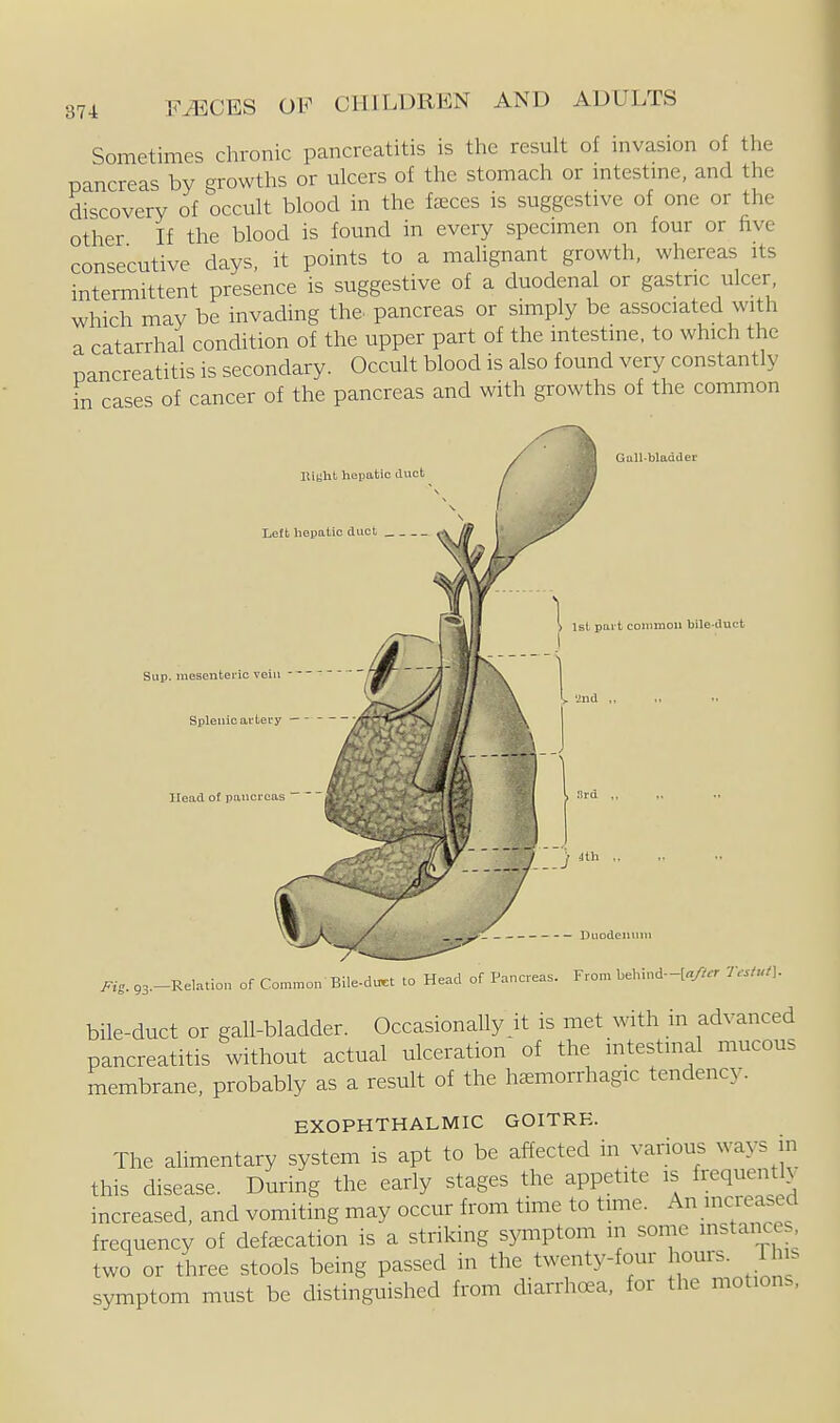 Sometimes chronic pancreatitis is the result of mvasion of the pancreas by growths or ulcers of the stomach or mtestme, and the discovery of occult blood in the feeces is suggestive of one or the other If the blood is found in every specimen on four or five consecutive days, it points to a malignant growth, whereas its intermittent presence is suggestive of a duodenal or gastnc ulcer, which may be invading the. pancreas or simply be associated with a catarrhal condition of the upper part of the intestine, to which the pancreatitis is secondary. Occult blood is also found very constantly in cases of cancer of the pancreas and with growths of the common Bight hepatic duct Left hepatic duct Sup. raesentei'io vein -- Splenic ai'tery — Head of pancreas ~ Gull-bladder st part common bile-duct 2nd ,, nrd ,, Mg. 93.-Relation of Common Bile-du^t to Head of Pancreas. From behind-[«>-r TM bile-duct or gall-bladder. Occasionally it is met with m advanced pancreatitis without actual ulceration of the intestinal mucous membrane, probably as a result of the hcxmorrhagic tendency. EXOPHTHALMIC GOITRE. The alimentary system is apt to be affected in various ways in this disease. During the eariy stages the appetite is frequently increased, and vomiting may occur from time to time. An increased frequency of defecation is a striking symptom in some instance two or three stools being passed in the twenty-four ^ours. Ihis symptom must be distinguished from diarrhc^a, for the motions,