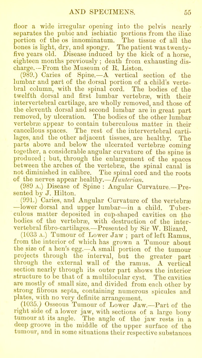 floor a wide irregular opening into the pelvis nearly separates the pubic and ischiatic portions from the iliac portion of the os innominatum. The tissue of all the iDones is light, dry, and spongy. The patient was twenty- five years old. Disease induced by the kick of a horse, eighteen months previously ; death from exhausting dis- charge.—From the Museum of R. Liston. (989.) Caries of Spine.—A vertical section of the lumbar and part of the dorsal portion of a child's verte- bral column, with the spinal cord. The bodies of the twelfth dorsal and first lumbar vertebrae, with their intervertebral cartilage, are wholly removed, and those of the eleventh dorsal and second lumbar are in great part removed, by ulceration. The bodies of the other lumbar vertebrae appear to contain tuberculous matter in their cancellous spaces. The rest of the intervertebral carti- lages, and the other adjacent tissues, are healthy. The parts above and below the ulcerated vertebr£e coming together, a considerable angular curvature of the spine is produced ; but, through the enlargement of the spaces between the arches of the vertebrae, the spinal canal is not diminished in calibre. The spinal cord and the roots of the nerves appear healthy.—Hunterian. (989 A.) Disease of Spine : Angular Curvature.—Pre- sented by J. Hilton. (991.) Caries, and Angular Curvature of the vertebr£e —lower dorsal and upper lumbar—in a child. Tuber- culous matter deposited in cup-shaped cavities on the bodies of the vertebraa, with destruction of the inter- vertebral fibro-cartilages.—Presented by Sir W. Blizard. (1033 A.) Tumour of Lower Jaw ; part of left Ramus, from the interior of which has grown a Tumour about the size of a hen's egg.—A small portion of the tumour projects through the interval, but the greater part through the external wall of the ramus. A vertical section nearly through its outer part shows the interior structure to be that of a multilocular cyst. The cavities are mostly of small size, and divided from each other by strong fibrous septa, containing numerous spicules and plates, with no very definite arrangement. (1035.) Osseous Tumour of Lower Jaw.—Part of the right side of a lower jaw, with sections of a large bony tumour at its angle. The angle of the jaw rests in a deep groove in the middle of the upper surface of the tumour, and in some situations their respective substances