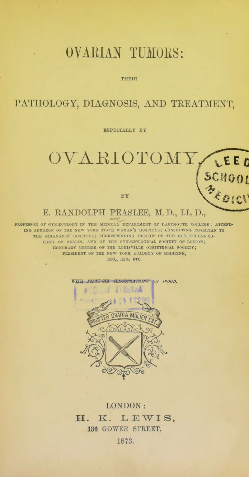 OVAEIAN TUMOiiS: THKIK PATHOLOGY, DIAGNOSIS, AND TREATMENT, ESPECIALLY BY OVAEIOTOMT/CTeI ( SCHOOL E. RAN^DOLPH PEASLEE, M. D., LL. D., ^ PE0FE8S0R OF GYN.ECOLOGY IN THE MEDICAL DEPARTMENT OP DARTMOUTn COLLEGE; ATTKOT)- ING SURGEON OP THE NEW YORK STATE WOMAN'S HOSPITAL; CONSULTING PHYSICIAN TO THE strangers' HOSPITAL; CORRESPONDING FELLOW OF THE OBSTETRICAL SO- CIETY OF BERLIN, AND OF THE GYNJJCOLOGICAL SOCIETY OP BOSTON; HONORARY MEMBER OP THE LOUISVILLE OBSTETRICAL SOCIETY; PRESIDENT OF THE NEW YORK ACADEMY OF MEDICINE, ETC., £10., GIO. miE FIFTY-SIX ILLirSTRATlOm O.V WOOD. LONDON: H. K. LEWIS, 1S6 GOWER STREET. 1873.