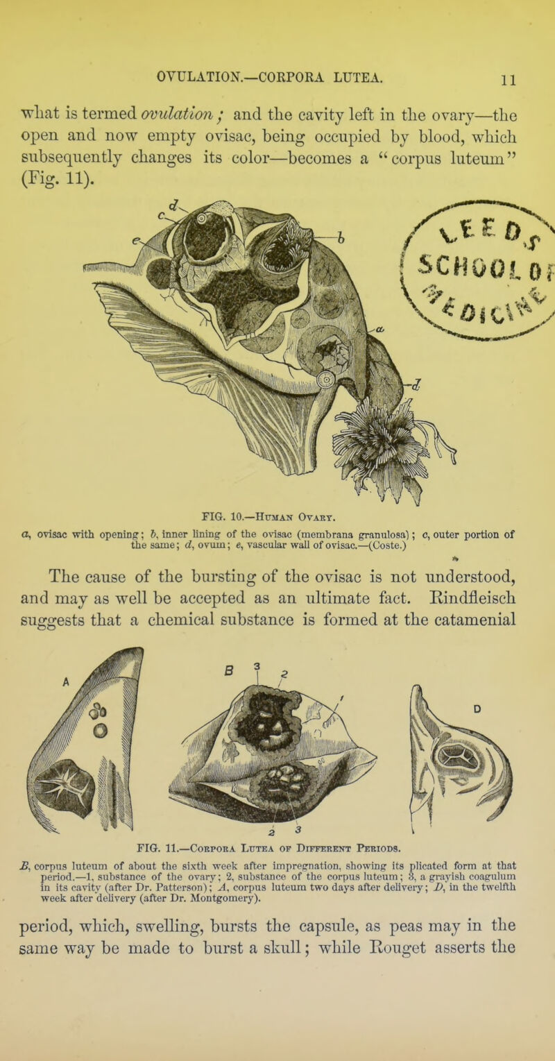 OVULATION.—CORPORA LUTEA. wliat is termed ovulation ; and the cavity left in the ovary—the open and now empty ovisac, being occupied by blood, which subsequently changes its color—becomes a corpus luteum (Fig. 11). FIG. 10.—Human Ovary. o, ovisac with opening; 6, inner lining of the ovisac (membrana granulosa); c, outer portion of the same; d, ovuin; e, vascular wall of ovisac.—(Coste.) The cause of the bursting of the ovisac is not understood, and may as well be accepted as an ultimate fact. Eindfleisch sufffjests that a chemical substance is formed at the catamenial FIG. 11.—Corpora Lutea of Different Periods. corpus lutcum of about the sixth week after impregnation, showing its plicated form at that period.—1, substance of the ovary; 2, substance of the corpus luteum; 3, a grayish coagulum in its cavity (after Dr. Patterson); corpus luteum two days after deliveiy; Z*, in the twelfth week after deUvery (after Dr. Montgomery). period, which, swelling, bursts the capsule, as peas may in the same way be made to burst a skull; while Rouget asserts the
