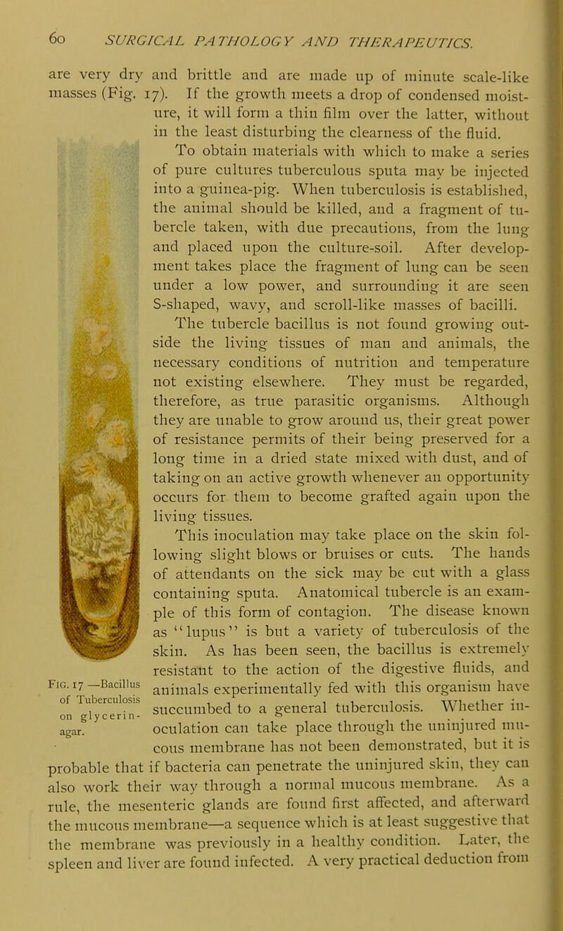 are very dry and brittle and are made up of minute scale-like masses (Fig, 17). If the growth meets a drop of condensed moist- ure, it will form a thin film over the latter, without in the least disturbing the clearness of the fluid. To obtain materials with which to make a series of pure cultures tuberculous sputa may be injected into a guinea-pig. When tuberculosis is established, the animal should be killed, and a fragment of tu- bercle taken, with due precautions, from the lung and placed upon the culture-soil. After develop- ment takes place the fragment of lung can be seen under a low power, and surrounding it are seen S-shaped, wavy, and scroll-like masses of bacilli. The tubercle bacillus is not found growing out- side the living tissues of man and animals, the necessary conditions of nutrition and temperature not existing elsewhere. They must be regarded, therefore, as true parasitic organisms. Although they are unable to grow around us, their great power of resistance permits of their being preserved for a long time in a dried state mixed with dust, and of taking on an active growth whenever an opportunity occurs for them to become grafted again upon the living tissues. This inoculation may take place on the skin fol- lowing slight blows or bruises or cuts. The hands of attendants on the sick may be cut with a glass containing sputa. Anatomical tubercle is an exam- ple of this form of contagion. The disease known as lupus is but a variety of tuberculosis of the skin. As has been seen, the bacillus is extremely resistant to the action of the digestive fluids, and animals experimentally fed with this organism have succumbed to a general tuberculosis. Whether in- oculation can take place through the uninjured mu- cous membrane has not been demonstrated, but it is probable that if bacteria can penetrate the uninjured skin, they can also work their way through a normal mucous membrane. As a rule, the mesenteric glands are found first affected, and afterward the mucous membrane—a sequence which is at least suggestive that the membrane was previously in a healthy condition. Later, the spleen and liver are found infected. A very practical deduction from Fig. 17 —Bacillus of Tuberculosis on glycerin- agar.