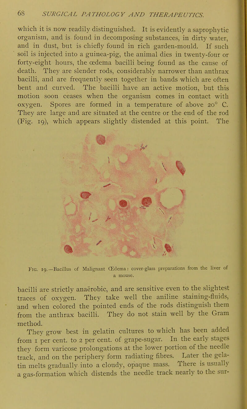 which it is now readily distinguished. It is evidently a saprophytic organism, and is found in decomposing substances, in dirty water, and in dust, but is chiefly found in rich garden-mould. If such soil is injected into a guinea-pig, the animal dies in twenty-four or forty-eight hours, the oedema bacilli being found as the cause of death. They are slender rods, considerably narrower than anthrax bacilli, and are frequently seen together in bands which are often bent and curved. The bacilli have an active motion, but this motion soon ceases when the organism comes in contact with oxygen. Spores are formed in a temperature of above 20° C. They are large and are situated at the centre or the end of the rod (Fig. 19), which appears slightly distended at this point. The Fig. 19.—Bacillus of Malignant CEdema: cover-glass preparations from the liver of a mouse. bacilli are strictly anaerobic, and are sensitive even to the slightest traces of oxygen. They take well the aniline staining-fluids, and when colored the pointed ends of the rods distinguish them from the anthrax bacilli. They do not stain well by the Gram method. They grow best in gelatin cultures to which has been added from I per cent, to 2 per cent, of grape-sugar. In the early stages they form varicose prolongations at the lower portion of the needle track, and on the periphery form radiating fibres. Later the gela- tin melts gradually into a cloudy, opaque mass. There is usually a gas-formation which distends the needle track nearly to the sur-