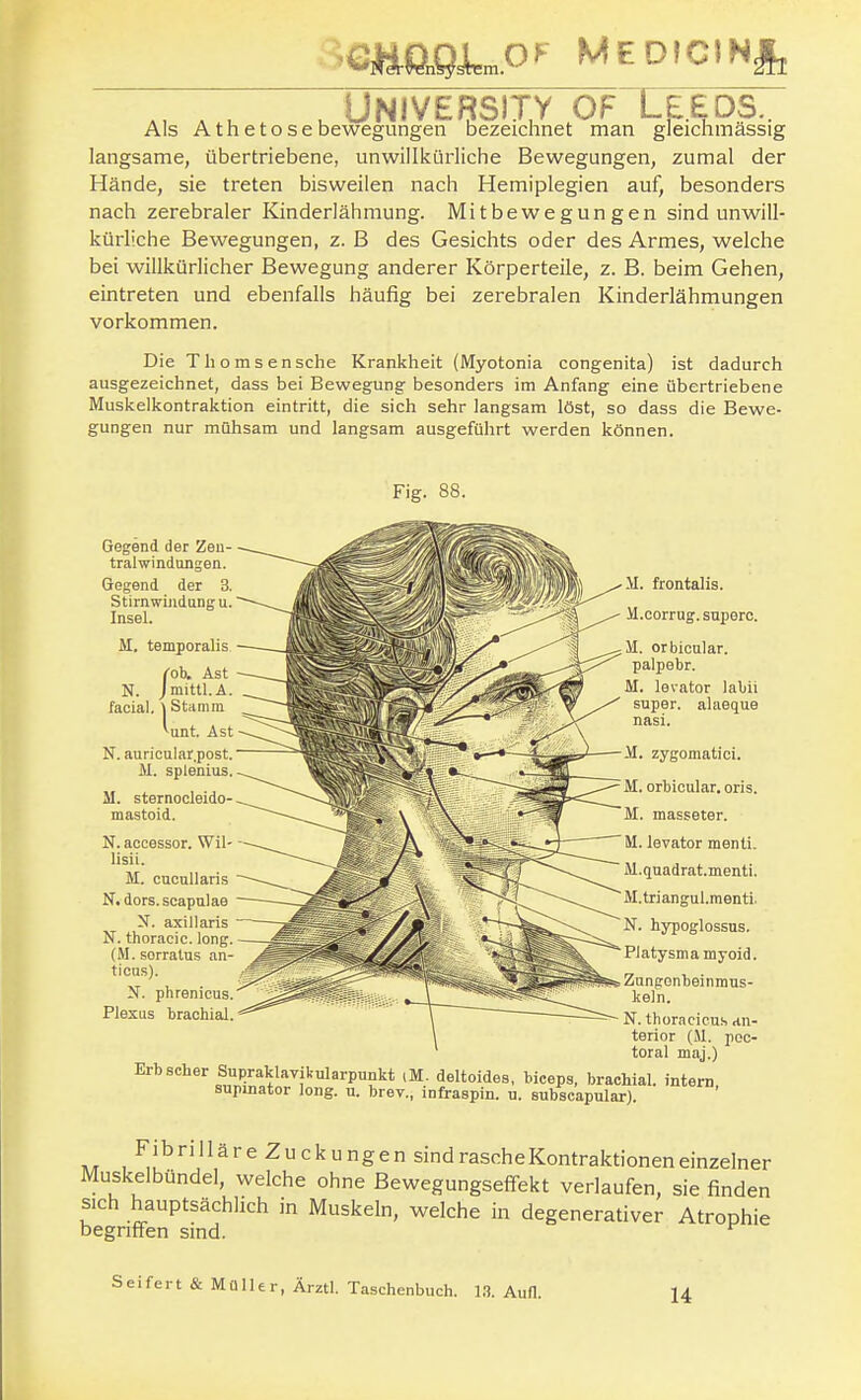 semmj)'-' MEDiciHj, , , , University OF LE.EDS.. Als A t h e t o s e bewegungen bezeichnet man gleichmässig langsame, übertriebene, unwillkürliche Bewegungen, zumal der Hände, sie treten bisweilen nach Hemiplegien auf, besonders nach zerebraler Kinderlähmung. Mitbewegungen sind unwill- kürliche Bewegungen, z. B des Gesichts oder des Armes, welche bei willkürlicher Bewegung anderer Körperteile, z. B. beim Gehen, eintreten und ebenfalls häufig bei zerebralen Kinderlähmungen vorkommen. Die Tliomsensche Krankheit (Myotonia congenita) ist dadurch ausgezeichnet, dass bei Bewegung besonders im Anfang eine übertriebene Muskelkontraktion eintritt, die sich sehr langsam löst, so dass die Bewe- gungen nur mühsam und langsam ausgeführt werden können. Fig. 88. Gegend der Zen- tral windungea. Gegend der 3. Stirnwiiidangu. Insel. M. temporalis N. /mittl.A. •l (o\ Ast , ;tl.A facial. \ Stamm '■unt. Ast N. auricular.post. M. splenius. M. sternocleido- mastoid. N. accessor. Wil- lisii. M. cucullaris N. dors. scapulae N. axillaris N. thoracic, long. (M. sorratus an- ticus). X. phrenicus. Plexus brachial. Erb scher Supraklavikularpunkt tM. deltoides, supinator long. u. brev., infraspin. u M. frontalis. M.corrug. snperc. il. orbicalar. palpebr. M. levator labii super, alaeque nasi. M. zygomatici. M. orbicular. oris. M. masseter. U. levator menti. M.qnadrat.menti. M.triangul.menti. N. hypoglossus. Platysma myoid. Zangonbeinmus- keln. N. thoracicus dn- terior (51. poc- toral maj.) biceps, brachial, intern, subscapular). A/r /'^^''^äre Zuckungen sind rasche Kontraktionen einzelner Muskelbündel, welche ohne Bewegungseffekt verlaufen, sie finden sich hauptsächlich in Muskeln, welche in degenerativer Atroph begriffen sind. ^ le S e i f e r t & M ü 11 e r, Ärztl. Taschenbuch. LS. Aufl. 14