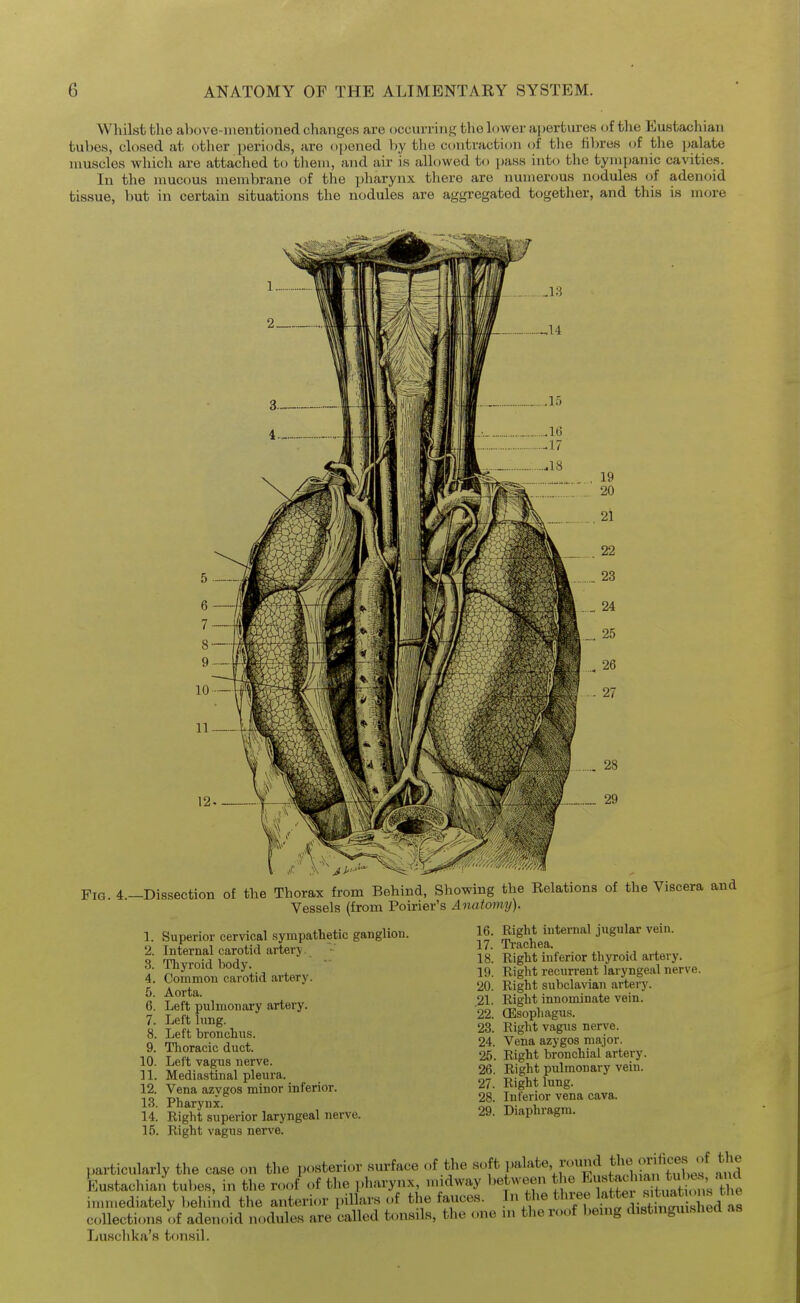 Whilst the above-mentioned changes are occurring the lower apertures of the Eustachian tubes, closed at other periods, are opened ))y the contraction of the fibres of the palate muscles which are attached to them, and air is allowed to pass into the tymijanic cavities. In tlie mucous membrane of the i^harynx there are numerous nodules of adenoid tissue, but in certain situations the nodules are aggregated together, and this is more Fig. 4—Dissection of the Thorax from Behind, Showing the Relations of the Viscera and Vessels (from Poirier's Anaiomy). 1. Superior cervical sympathetic ganglion. 2. Internal carotid artery. 3. Thyroid body. 4. Conimou carotid artery. 5. Aorta. 6. Left pulmonary artery. 7. Left lung. 8. Left bronchus. 9. Thoracic duct. 10. Left vagus nerve, n. Mediastinal pleura. 12. Vena azygos minor inferior. 13. Pharynx. 14. Right superior laryngeal nerve. 15. Right vagus nerve. 16. Right internal jugular vein. 17. Trachea. 18. Right inferior thyroid artery. 19. Right recurrent laryngeal nerve. 20. Right subclavian artery. .21. Right innominate vein. 22. (Esophagus. 23. Right vagus nerve. 24. Vena azygos major. 25. Right bronchial artery. 26. Right pulmonary vein. 27. Right lung. 28. Inferior vena cava. 29. Diaphragm. particularly the case on the posterior surface of the soft palate round J]^^, >^^^J^ Eustachian tubes, in the roof of the pharynx, nndway between the Eu« jchia tu^^^^^^^^^^ in.mediately behind the anterior pillars of the fauces. In the ^'^^f ^^^^^^^^ • collections of adenoid nodules are called tonsils, the one n, the roof bemg distniguished as Luschka's t()nsil.
