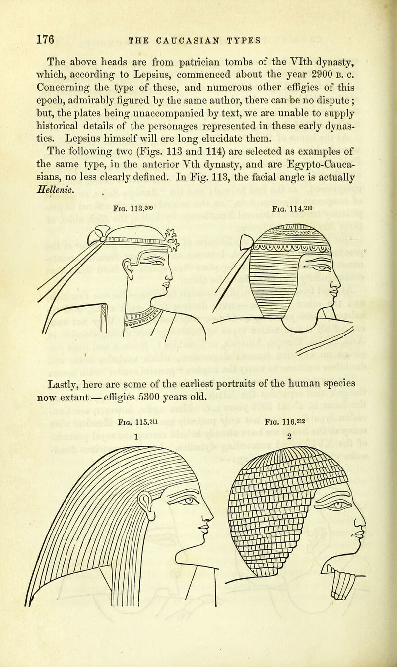 The above heads are from patrician tombs of the Vlth dynasty, which, according to Lepsius, commenced about the year 2900 b. c. Concerning the type of these, and numerous other effigies of this epoch, admirably figured by the same author, there can be no dispute; but, the plates being unaccompanied by text, we are unable to supply historical details of the personages represented in these early dynas- ties. Lepsius himself will ere long elucidate them. The following two (Figs. 113 and 114) are selected as examples of the same type, in the anterior Vth dynasty, and are Egypto-Cauca- sians, no less clearly defined. In Fig. 113, the facial angle is actually Hellenic. Fig. 113.209 Fig. 114.2i<> Lastly, here are some of the earliest portraits of the human species now extant — effigies 5300 years old. Fig. 115.2H Fid. 116.212 1 2