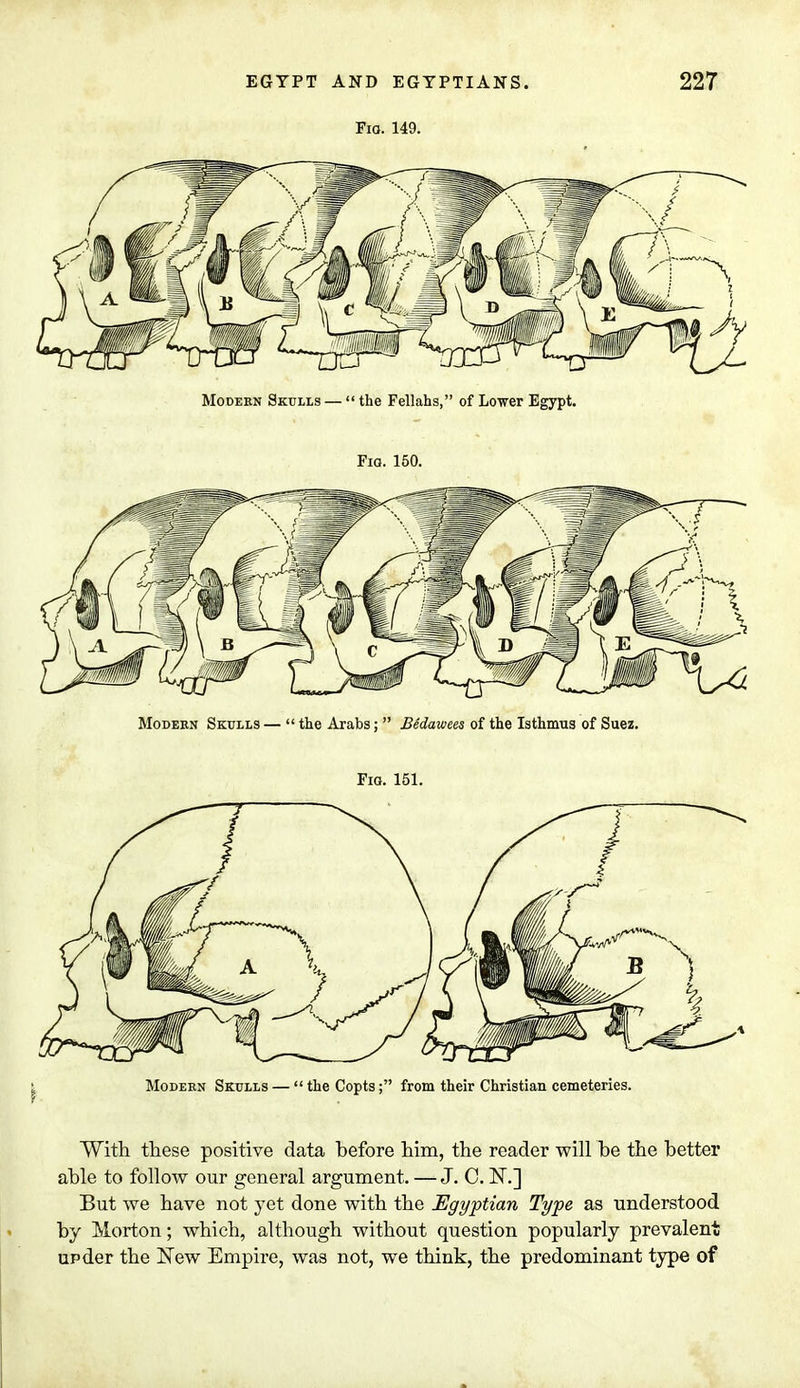 Fio. 149. Modern Skulls —  the Fellahs, of Lower Egypt. Fig. 150. Modern Skulls —  the Arabs;  Bedawees of the Isthmus of Suez. Fig. 151. Modern Skulls —  the Copts; from their Christian cemeteries. With these positive data before him, the reader will be the better able to follow our general argument. — J. C. N\] But we have not yet done with the Egyptian Type as understood by Morton; which, although without question popularly prevalent upder the New Empire, was not, we think, the predominant type of