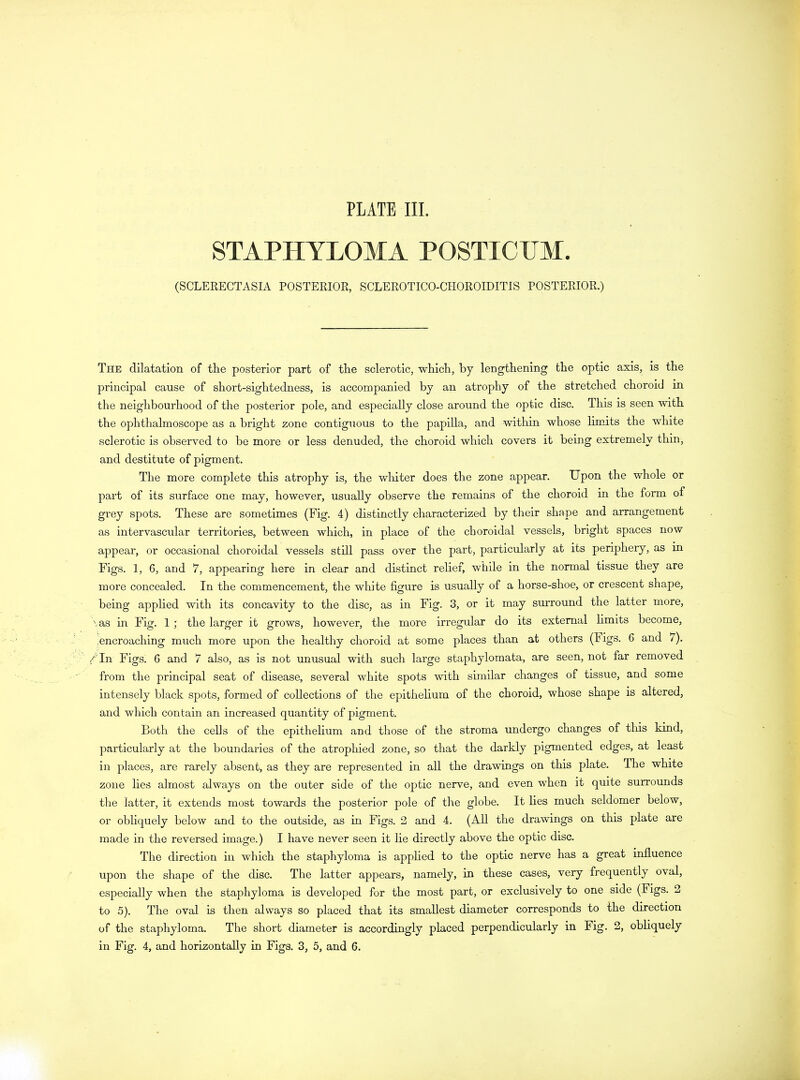 STAPHYLOMA POSTICTTM. (SCLERECTASIA POSTERIOR, SCLEROTICO-CHOROIDITIS POSTERIOR.) The dilatation of the posterior part of the sclerotic, which, by lengthening the optic axis, is the principal cause of short-sightedness, is accompanied by an atrophy of the stretched choroid in the neighbourhood of the posterior pole, and especially close around the optic disc. This is seen with the ophthalmoscope as a bright zone contiguous to the papilla, and within whose limits the white sclerotic is observed to be more or less denuded, the choroid which covers it being extremely thin, and destitute of pigment. The more complete this atrophy is, the whiter does the zone appear. Upon the whole or part of its surface one may, however, usually observe the remains of the choroid in the form of grey spots. These are sometimes (Fig. 4) distinctly characterized by their shape and arrangement as intervascular territories, between which, in place of the choroidal vessels, bright spaces now appear, or occasional choroidal vessels still pass over the part, particularly at its periphery, as in Figs. 1, 6, and 7, appearing here in clear and distinct relief, while in the normal tissue they are more concealed. In the commencement, the white figure is usually of a horse-shoe, or crescent shape, being applied with its concavity to the disc, as in Fig. 3, or it may surround the latter more, \as in Fig. 1 ; the larger it grows, however, the more irregular do its external limits become, 'encroaching much more upon the healthy choroid at some places than at others (Figs. 6 and /). /In Figs. 6 and 7 also, as is not unusual with such large staphylomata, are seen, not far removed from the principal seat of disease, several white spots with similar changes of tissue, and some intensely black spots, formed of collections of the epithelium of the choroid, whose shape is altered, and which contain an increased quantity of pigment. Both the cells of the epithelium and those of the stroma undergo changes of tins kind, particularly at the boundaries of the atrophied zone, so that the darkly pigmented edges, at least in places, are rarely absent, as they are represented in all the drawings on this plate. The white zone lies almost always on the outer side of the optic nerve, and even when it quite surrounds the latter, it extends most towards the posterior pole of the globe. It lies much seldomer below, or obliquely below and to the outside, as in Figs. 2 and 4. (All the drawings on this plate are made in the reversed image.) I have never seen it lie directly above the optic disc. The direction in which the staphyloma is applied to the optic nerve has a great influence upon the shape of the disc. The latter appears, namely, in these cases, very frequently oval, especially when the staphyloma is developed for the most part, or exclusively to one side (Figs. 2 to 5). The oval is then always so placed that its smallest diameter corresponds to the direction of the staphyloma. The short diameter is accordingly placed perpendicularly in Fig. 2, obliquely