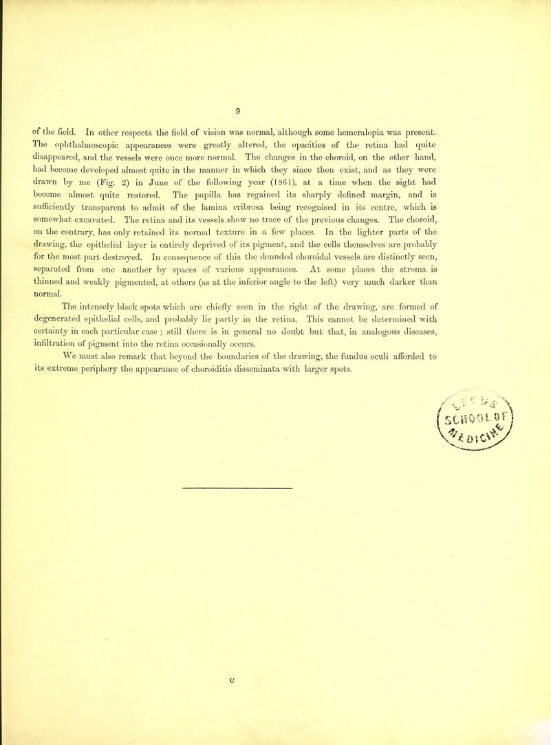 of the field. In other respects the field of vision was normal, although some hemeralopia was present. The ophthalmoscopic appearances were greatly altered, the opacities of the retina had quite disappeared, and the vessels were once more normal. The changes in the choroid, on the other hand, had become developed almost quite in the manner in which they since then exist, and as they were drawn by me (Fig. 2) in June of the following year (1861), at a time when the sight had become almost quite restored. The papilla has regained its sharply defined margin, and is sufficiently transparent to admit of the lamina cribrosa being recognised in its centre, which is somewhat excavated. The retina and its vessels show no trace of the previous changes. The choroid, on the contrary, has only retained its normal texture in a few places. In the lighter parts of the drawing, the epithelial layer is entirely deprived of its pigment, and the cells themselves are probably for the most part destroyed. In consequence of this the denuded choroidal vessels are distinctly seen, separated from one another by spaces of various appearances. At some places the stroma is thinned and weakly pigmented, at others (as at the inferior angle to the left) very much darker than normal. The intensely black spots which are chiefly seen in the right of the drawing, are formed of degenerated epithelial cells, and probably lie partly in the retina. This cannot be determined with certainty in each particular case ; still there is in general no doubt but that, in analogous diseases, infiltration of pigment into the retina occasionally occurs. We must also remark that beyond the boundaries of the drawing, the fundus oculi afforded to its extreme periphery the appearance of choroiditis disseminata with larger spots. C-