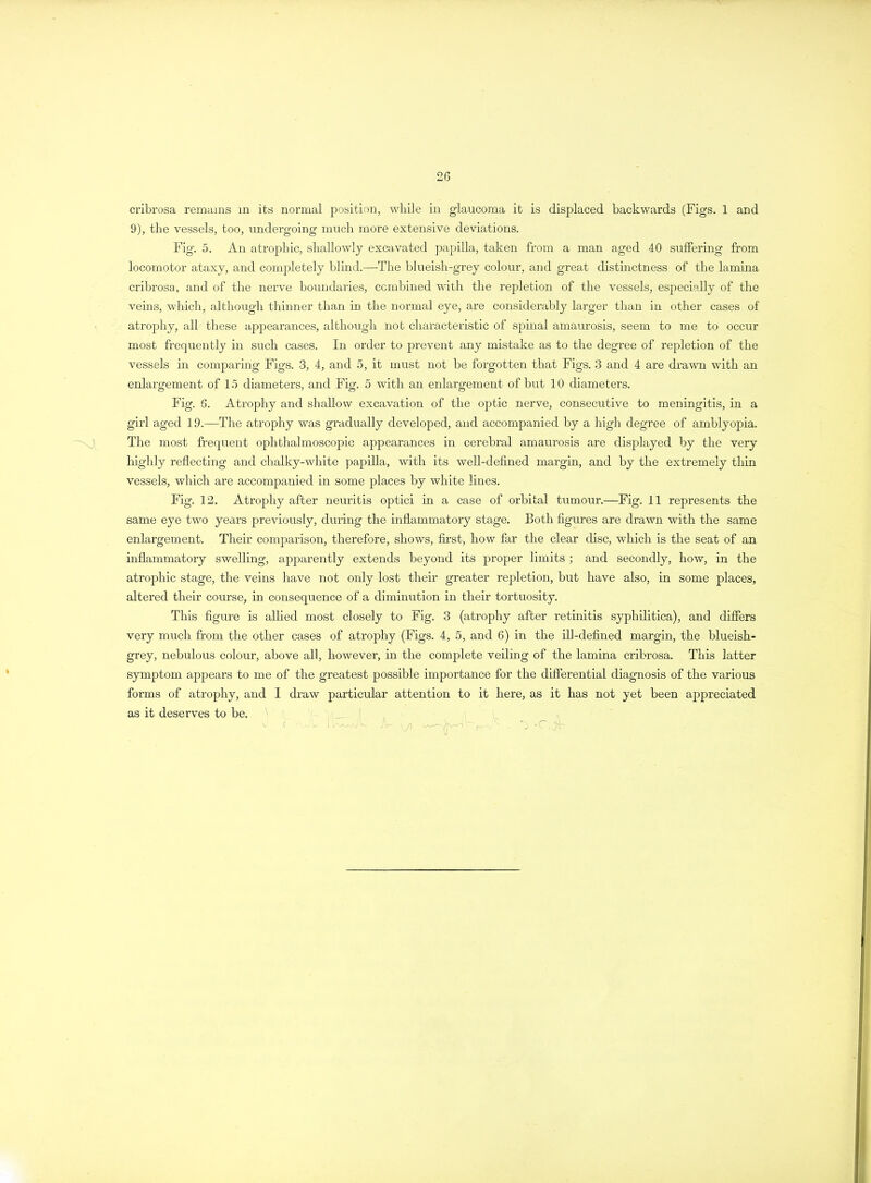 cribrosa remains in its normal position, while in glaucoma it is displaced backwards (Figs. 1 and 9), the vessels, too, undergoing much more extensive deviations. Fig. 5. An atrophic, shallowly excavated papilla, taken from a man aged 40 suffering from locomotor ataxy, and completely blind.—The blueish-grey colour, and great distinctness of the lamina cribrosa, and of the nerve boundaries, combined with the repletion of the vessels, especially of the veins, which, although thinner than in the normal eye, are considerably larger than in other cases of atrophy, all these appearances, although not characteristic of spinal amaurosis, seem to me to occur most frequently in such cases. In order to prevent any mistake as to the degree of repletion of the vessels in comparing Figs. 3, 4, and 5, it must not be forgotten that Figs. 3 and 4 are drawn with an enlargement of 15 diameters, and Fig. 5 with an enlargement of but 10 diameters. Fig. 6. Atrophy and shallow excavation of the optic nerve, consecutive to meningitis, in a girl aged 19.—The atrophy was gradually developed, and accompanied by a high degree of amblyopia. The most frequent ophthalmoscopic appearances in cerebral amaurosis are displayed by the very highly reflecting and chalky-white papilla, with its well-defined margin, and by the extremely thin vessels, which are accompanied in some places by white lines. Fig. 12. Atrophy after neuritis optici in a case of orbital tumour.—Fig. 11 represents the same eye two years previously, during the inflammatory stage. Both figures are drawn with the same enlargement. Their comparison, therefore, shows, first, how far the clear disc, which is the seat of an inflammatory swelling, apparently extends beyond its proper limits ; and secondly, how, in the atrophic stage, the veins have not only lost their greater repletion, but have also, in some places, altered their course, in consequence of a diminution in their tortuosity. This figure is allied most closely to Fig. 3 (atrophy after retinitis syphilitica), and differs very much from the other cases of atrophy (Figs. 4, 5, and 6) in the ill-defined margin, the blueish- grey, nebulous colour, above all, however, in the complete veiling of the lamina cribrosa. This latter symptom appears to me of the greatest possible importance for the differential diagnosis of the various forms of atrophy, and I draw particular attention to it here, as it has not yet been appreciated as it deserves to be. *3 -C