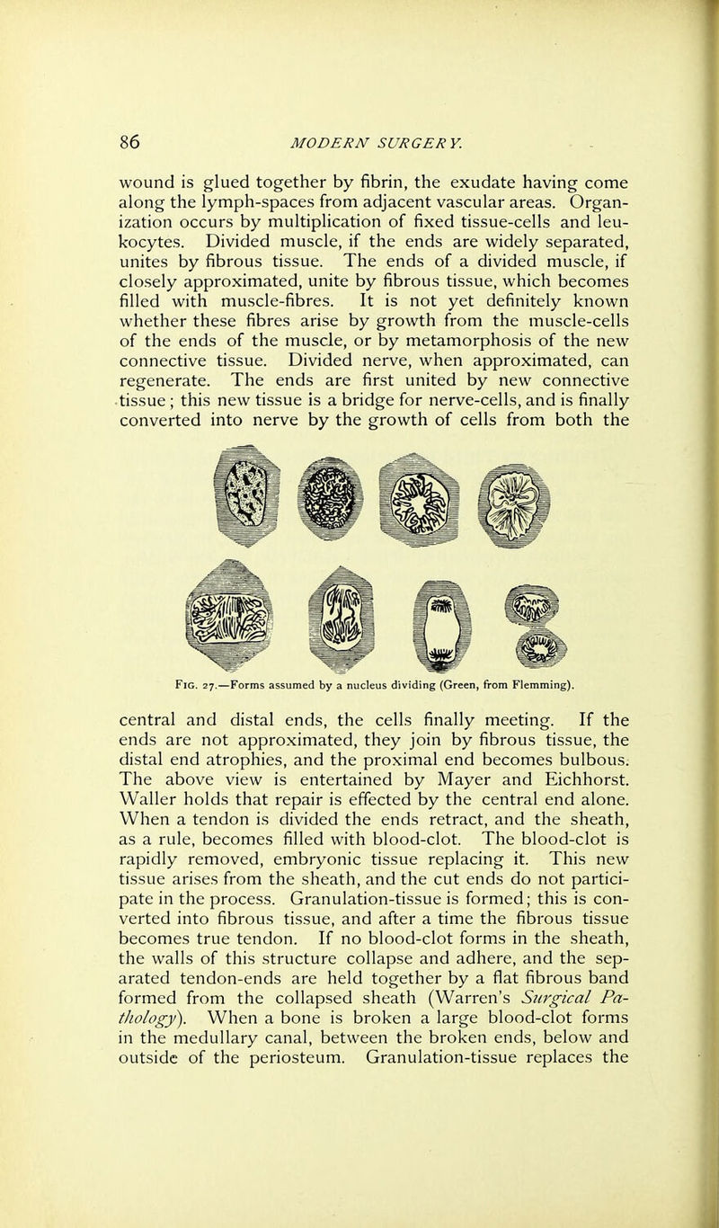 wound is glued together by fibrin, the exudate having come along the lymph-spaces from adjacent vascular areas. Organ- ization occurs by multiplication of fixed tissue-cells and leu- kocytes. Divided muscle, if the ends are widely separated, unites by fibrous tissue. The ends of a divided muscle, if closely approximated, unite by fibrous tissue, which becomes filled with muscle-fibres. It is not yet definitely known whether these fibres arise by growth from the muscle-cells of the ends of the muscle, or by metamorphosis of the new connective tissue. Divided nerve, when approximated, can regenerate. The ends are first united by new connective tissue; this new tissue is a bridge for nerve-cells, and is finally converted into nerve by the growth of cells from both the Fig. 27.—Forms assumed by a nucleus dividing (Green, from Flemming). central and distal ends, the cells finally meeting. If the ends are not approximated, they join by fibrous tissue, the distal end atrophies, and the proximal end becomes bulbous. The above view is entertained by Mayer and Eichhorst. Waller holds that repair is effected by the central end alone. When a tendon is divided the ends retract, and the sheath, as a rule, becomes filled with blood-clot. The blood-clot is rapidly removed, embryonic tissue replacing it. This new tissue arises from the sheath, and the cut ends do not partici- pate in the process. Granulation-tissue is formed; this is con- verted into fibrous tissue, and after a time the fibrous tissue becomes true tendon. If no blood-clot forms in the sheath, the walls of this structure collapse and adhere, and the sep- arated tendon-ends are held together by a flat fibrous band formed from the collapsed sheath (Warren's Surgical Pa- thology). When a bone is broken a large blood-clot forms in the medullary canal, between the broken ends, below and outside of the periosteum. Granulation-tissue replaces the
