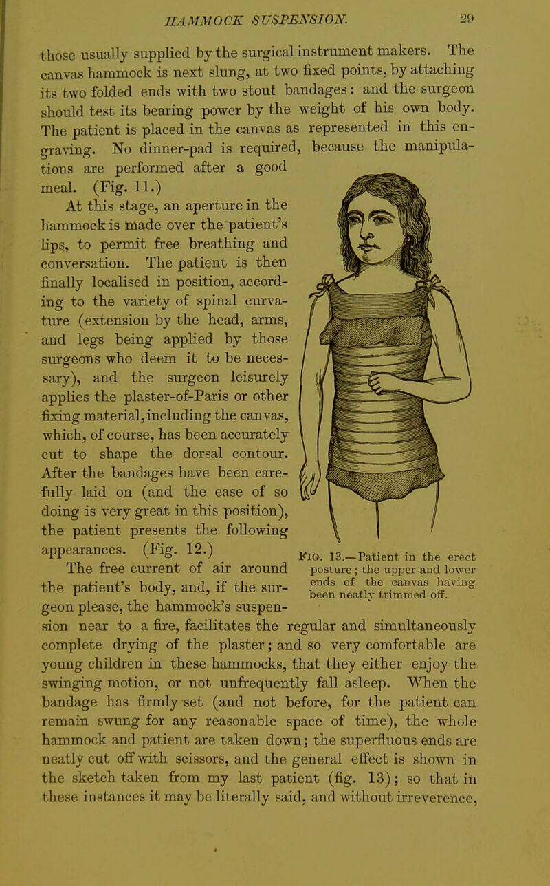 those usually supplied by the surgical instrument makers. The canvas hammock is next slung, at two fixed points, by attaching its two folded ends with two stout bandages : and the surgeon should test its bearing power by the weight of his own body. The patient is placed in the canvas as represented in this en- graving. No dinner-pad is required, because the manipula- tions are performed after a good meal. (Fig. 11.) At this stage, an aperture in the hammock is made over the patient's lips, to permit free breathing and conversation. The patient is then finally localised in position, accord- ing to the variety of spinal curva- ture (extension by the head, arms, and legs being applied by those surgeons who deem it to be neces- sary), and the surgeon leisurely applies the plaster-of-Paris or other fixing material, including the canvas, which, of course, has been accurately cut to shape the dorsal contour. After the bandages have been care- fully laid on (and the ease of so doing is very great in this position), the patient presents the following appearances. (Fig. 12.) The free current of air around the patient's body, and, if the sur- geon please, the hammock's suspen- sion near to a fire, facilitates the regular and simultaneously complete drying of the plaster; and so very comfortable are young children in these hammocks, that they either enjoy the swinging motion, or not unfrequently fall asleep. When the bandage has firmly set (and not before, for the patient can remain swung for any reasonable space of time), the whole hammock and patient are taken down; the superfluous ends are neatly cut off with scissors, and the general effect is shown in the sketch taken from my last patient (fig. 13); so that in these instances it may be literally said, and without irreverence, Fig. 13.—Patient in the erect posture ; the upper and lower ends of the canvas Jiaving been neatly trimmed off.