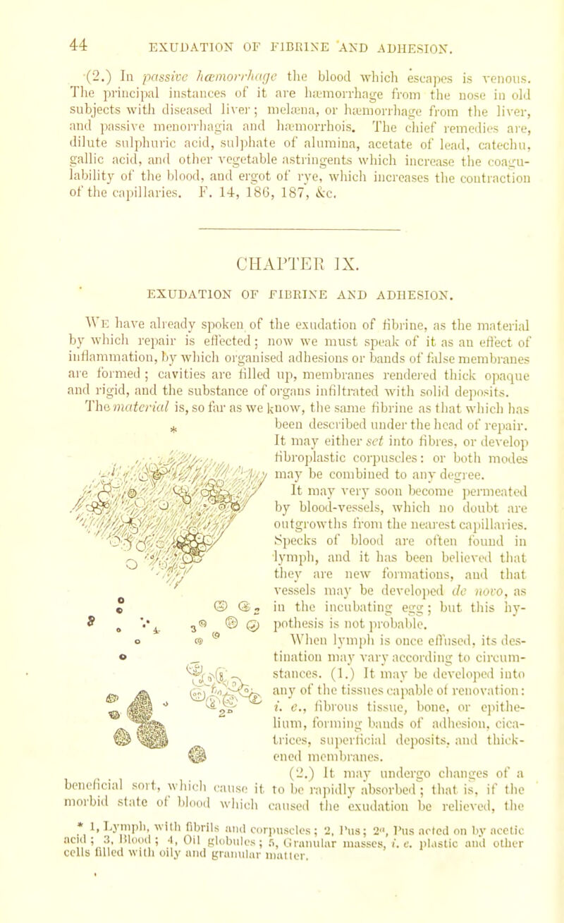 (2.) Ill passive hamorrhagc the blood which escapes is venous. The principal instances of it are h;emorrhage from the nose in old subjects with diseased livei'; meL-cna, or hiumorrhage from the liver, and passive menoi'i'hagia and ha^morrhois. The chief remedies are, dilute sulphuric acid, suljjhate of alumina, acetate of lead, catechu, gallic acid, and other vegetable astringents which increase the coairu- lability of the Ijlood, and ergot of rye, wWch increases the contraction of the capillaries. F. 14, fSG, 187, &c. CHAPTER IX. EXUDATION OF FIBRIXE AND ADHESION. We have already spoken of the exudation of fibrine, as the material by whicli repair is effected; now we must speak of it as an etiijct of inlfammation, by which organised adhesions or bands of false membranes are fbimed ; cavities are tilled up, membranes rendei'ed thiclc opaque and rigid, and the substance of organs infiltrated with solid deposits. 'n-i&material is, so tar as we know, the same iibrine as that which has ,1, been desci ibed under the head of repair. It may eitlier set into fibres, or de\elop fibro]jlastic corpuscles: or both modes may be combiued to any degree. It may very soon become permeated by blood-vessels, whicli no doubt are outgi'owths from the neiu'est cajiillaries. Sjjecks of blood are often found in lymph, and it lias been believed tliat they are new formations, and that vessels may be developed de novo, as in the incubating egs ; but this hy- pothesis is not probable. When lymph is once elfused, its des- _ tination may vary according to circum- ti^^G^ 'V stances. (1.) It may be developed into i^^'y^<^ an)' of the tissues capable ot renovation: ^^■^^ i.e., fib, ■ous tissue, bone, or e])ithe- lium, forming bands of adhesion, cica- trices, superficial deposits, and thick- @ ened meml)ranes. (2.) It may undergo changes of a beneficial soit, which cause it to be rapidly absorber; that is, if the morbid state of blood wlucli caused tlie exudation be relieved, the * 1, Lympli witli fibrils and corpuscles ; •>, Pus; 2, ]'»s acted on Iiy acetic '^1. .', ' ''• Kl>'bi'lcs ; .1, Linimiliir masses, /. c. pKislic aiul other cells tilled with oily and grumilar niuller.