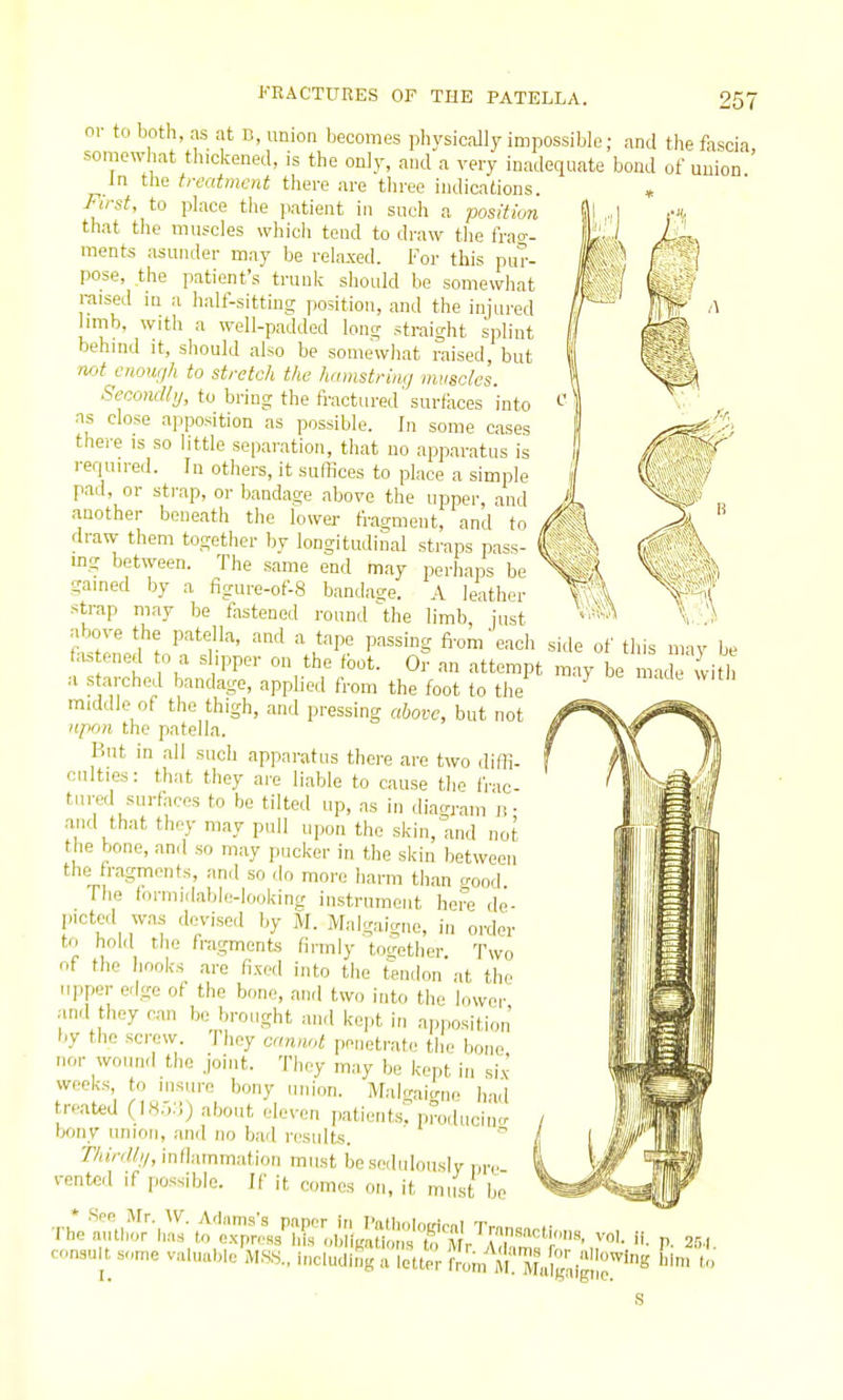 or to both, as at B, union becomes physically impossible; and the fascia somewhat thickened, is the only, and a very inadequate bond of union ' in the treatment there are three indications. « First, to place the patient in such a position that the muscles which tend to di-aw the frao- ments asunder may be relaxed. For this pur- pose, the patient's trunk should be somewliat raised in a half-sittiug position, and tlie injured limb, with a well-padded lone; straight splint behind it, should also be somewhat raised, but not enough to stretch the hamstring muscles. SecomUtj, to bring the fractured'surfaces into ns close apposition as possible. In some cases there is so little separation, that no apparatus is required. In others, it suffices to place a simple pad, or strap, or bandage above the upper, and another beneath the lower f^-agment, and to draw them together by longitudinal straps pass- mg between. The same end may perhaps be gained by a figure-of-8 bandage. A leather strap may be fastened round \he limb, just above the patella, and a tape passing fi-om'eaoh side of this may be fastened to a slipper on the fbot. Or an attempt may be made with ■A s arched bandage, applied from the foot to tlie ^ middle of the thigh, and pressing above, but not npon the patella. Bnt in all such apparatus there are two diffi. culties: that they are liable to cause tlie frac- tured surfaces to be tilted up, as in diao-ram n • and that they may pull upon the skin, and not the bone, and so may pucker in the skin between the fragments, and so do more harm than o-ood The tormidable-looking instrument he?e de- picted was devised by M. Malgaignc, in order to hold the fragments firmly together. Two of the hooks arc fi.xed into the tendon at the upper erige of the bone, and two into the lower and they can be brought and kept in apposition by the screw, fhey cannot penetrate the bone nor wound the joint. They may be kept in six- weeks, to insure bony union. Malcraicrnc had treated (185:1) about eleven patients? produciiK. bony union, and no bad results. r/(jVY%, inflammation must be sedulously ,„v vented if possible. If it comes on, it must be consult some valnalMe M.S.S.. Mu., ^Wa^r fiom m'™,l''i l> a letter from m'. Mn\^,^]^ :iie.