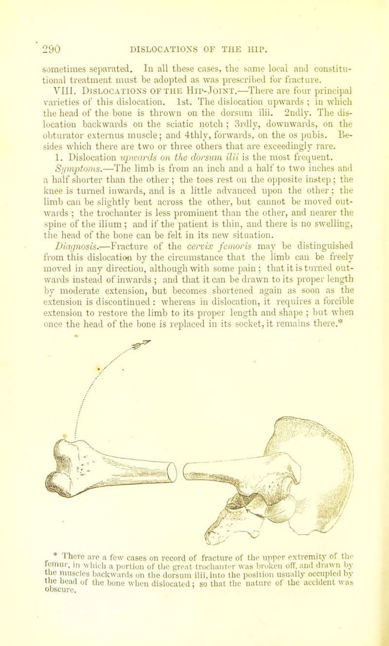 sometimes separated. In all these cases, the same local and constitu- tional treatment must be adopted as was prescribed for fracture. VIII. Dislocations of the Hip-Joint.—There are four principal varieties of this dislocation. 1st. The dislocation upwards : in which tlie head of the bone is thrown on the dorsum ilii. 2ndly. The dis- location baclcwards on the sciatic notch ; 3rdly, downwards, on the obturator externus muscle; and 4thly, forwards, on the os pubis. Be- sides which there are two or three others that are exceedingly rare. 1. Dislocation upwards on the dorsum ilii is the most frequent. Sijinptoins.—The limb is from an inch and a half to two inches and a half shorter than the other ; the toes rest on the opposite instep; the Icnee is turned inwards, and is a little advanced upon the other; the limb can be slightly bent across the other, but cannot be moved out- wards ; the trochanter is less prominent than the other, and nearer the spine of the ilium ; aud if the patient is thin, and there is no swelling, the head of the bone can be felt in its new situation. Diagnosis.—Fracture of the cervix feinoris may be distinguished from this dislocation by the circumstance that the limb can be freely moved in any direction, although with some pain; that it is turned out- wards instead of inwards; and that it can be diawn toils proper length by moderate extension, but becomes shortened again as soon as the extension is discontinued : whereas in dislocation, it recjuires a forcible extension to restore the limb to its proper length aud shape : but when once the head of the bone is replaced in its socket, it remains tliere.* * There are a few cases on record of fracture of the upper extremity of tli.' femur, in wliiih a portion of tljo great truoliimlcr was hrukeii off. ami drawn by the muscles backwards on the dorsum ilii, into the posiliou usuall,y occupied by the heart of the bone when dislocated : so that the nature of the accident was obscure.