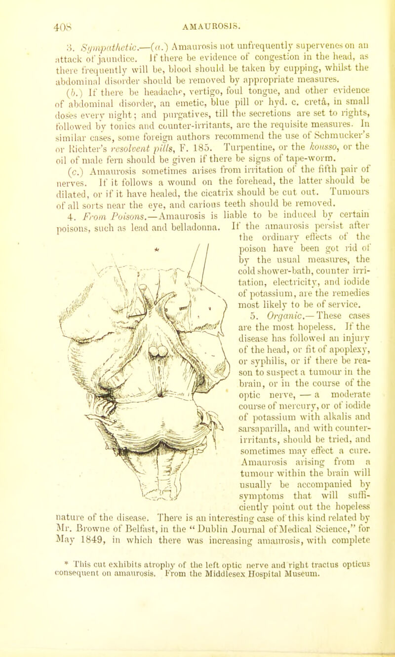 3. Syinpnthctic.—(n.) Aniivavosis not uufrequently supervenes on an Mttack ofjamulice. Jf there be evidence of congestion iu the head, as there frequently will be, blooil should be talien by cupping, whilst the abdominal dismder should be removed by appropriate measures. (6.) If tliere bo lieadachp, vertigo, foul tongue, and other evidence of abdominal disorder, an emetic, blue pill or hyd. c. creta, in small doses everv night; and purgatives, till the secretions are set to rights, followed by tonics and counter-irritants, arc the requisite measures. In similar coses, some foreign authors recommend the use of Schmucker's or liichter's resoloent pills, F. 185. Turpentine, or the kousso, or the oil of male fern should be given if there be signs of tape-worm. (c.) Amaurosis sometimes arises from irritation of the fifth pair of nerves. If it follows a wound on the forehead, the latter should be dilated, or if it have healed, the cicatrix should be cut out. Tumours of all sorts near the eye, and carious teeth should be removed. 4. From Poisoras.—Amaurosis is liable to be induced by certain poisons, such as lead and belladonna. If the amaurosis pci-sist after the ordinary eflects of the poison have been got rid of by the usual measiu-es, the cold shower-bath, couutei- irri- tation, electricity, and iodide of potassium, are the remedies most likely to be of service. 5. Organic.— These cases are the most hopeless. If the disease has followed an injury of the head, or lit of apoplexy, or syphilis, or if there be rea- son to suspect a tumom' in the brain, or in the coiu'se of the optic nerve, — a modeiate course of mercury, or of iodide of potassium with alkalis and sarsaparilla, and with counter- irritants, should he tried, and sometimes may efiect a cure. Amaurosis arising from a tumour within the brain will usually be accompanied by symptoms that will suffi- ciently point out the hopeless nature of the disease. There is an interesting case of this kind related by Mr. Browne of Belfiist, in the  Dublin Journal of Jledical Science, for May 1849, in which there was increasing .amaurosis, with complete * This cut exhibits atrophy of the left optic nerve and right Iractus opticus consequent on anuuu-osis. From the Middlesex Hospital Museum.