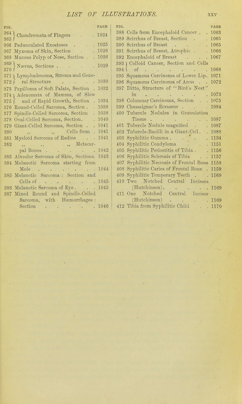 FIO. PAGE 1 Chondronmta of Fingers . . 1024 365 J 366 Pedunculated Exostoses . . . 1025 367 Myxoma of Skin, Section . 1026 368 Mucous Polyji of Nose, Section . . 1026 ^^^iNfevus, Sections . . . .1029 370 J 3711^ Lymjiliadenoma, Stroma and Gene- 372 J ral Structure . . . . 1030 373 Papilloma of Soft Palate, Section . 1032 3741 Adenomata of Mamma, of Slow 375 / and of Rapid Growth, Section . 1034 376 Round-Celled Sarcoma, Section . . 1038 377 Spindle-Celled Sarcoma, Section . 1038 378 Oval-Celled Sarcoma, Section. . 1040 379 Giant-Celled Sarcoma, Section . . 1041 380 ,, ., Cells from . 1041 381 Myeloid Sarcoma of Radius . . 1041 382 ,, ,, ,, Metacar- pal Bones 1042 383 Alveolar Sarcoma of Skin, Sections. 1043 384 Melanotic Sarcoma starting from Mole . . . • . . . 1044 385 Melanotic Sarcoma : Section and Cells of 1045 386 Melanotic Sarcoma of Eye . . . 1045 387 Mixed Round and Spindle-Celled Sarcoma, with Hfcmorrhages : Section 1046 FIO. VAOK 388 Cells from Encephaloid Cancer . . 1063 389 Scirrhus of Breast, Section . . 1065 390 Scirrhus of Breast . . . . 1065 391 Scirrhus of Breast, Atrophic . . 1066 392 Encephaloid of Breast . . . 1067 393 ) Colloid Cancer, Section anil Cells 394 ( of 1068 395 Squamous Carcinoma of Lower Lip. 1071 396 Squamous Carcinoma of Anus . . 1072 397 Ditto, Structure of Birds Nest in 1073 398 Columnar Carcinoma, Section . . 1075 399 Chassaignac's Ecraseur . . . 1084 400 Tubercle Nodules in Granulation Tissue 1087 401 Tubercle Nodule magnified . . 1087 402 Tubercle-Bacilli in a Giant-Cell. . 1088 403 Syphilitic Gumma . . * . . 1134 404 Syphilitic Condyloma . . .1151 405 Syphilitic Periostitis of Tibia . .1156 406 Syphilitic Sclerosis of Tibia . . 1157 407 Syphilitic Necrosis of Frontal Bone 1158 408 Syphilitic Caries of Frontal Bone . 1159 409 Syphilitic Temporary Teeth . . 1169 410 Two Notched Central Licisor.s (Hutchinson) 1169 411 One Notched Central Incisor (Hutchinson) .... 1169 412 Tibia from Syphilitic Child . .1170