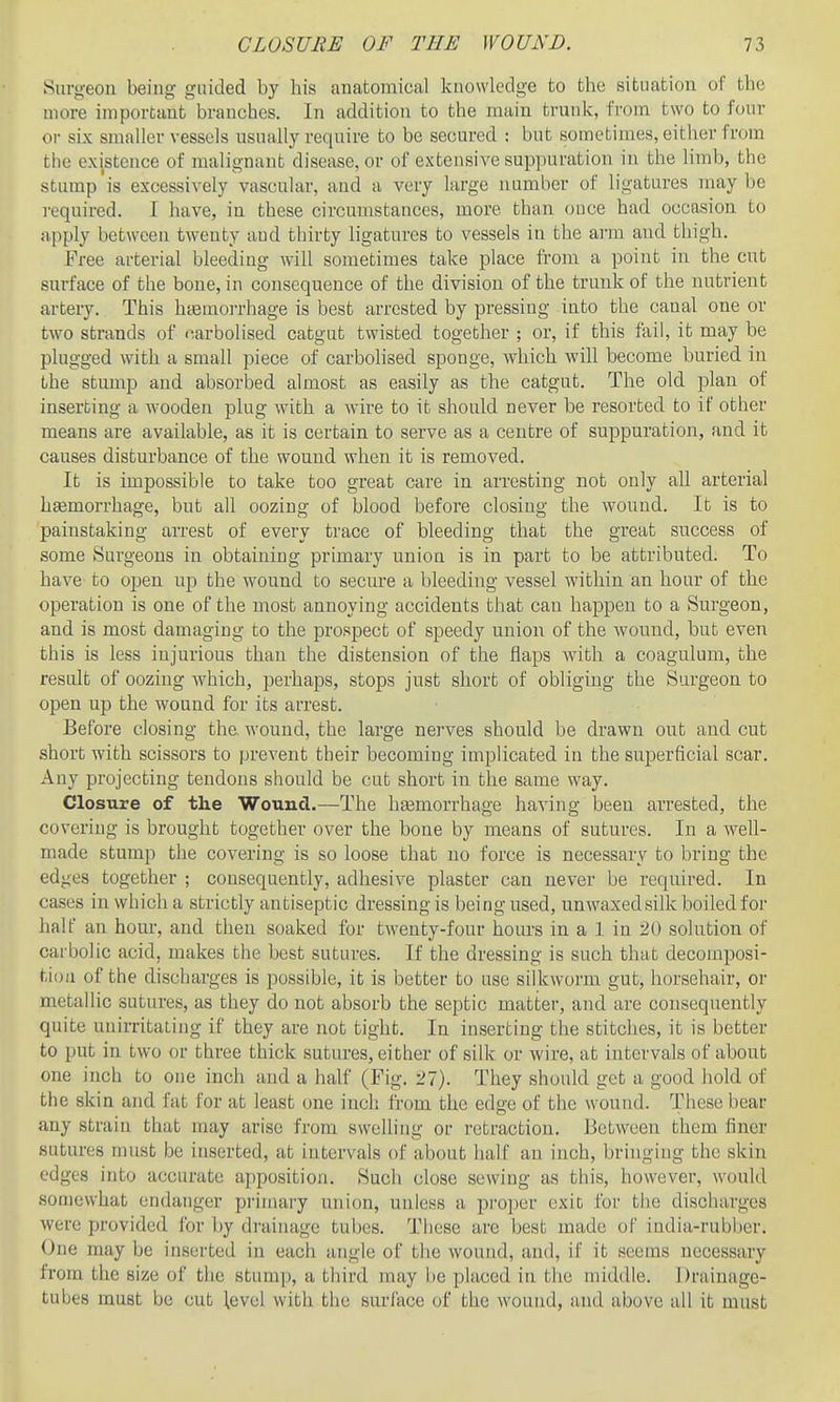 Surgeon being guided by his anatomical knowledge to the situation of the more important branches. In addition to the main trunk, from two to four or six smaller vessels usually require to be secured : but sometimes, either from the existence of malignant disease, or of extensive suppuration in the limb, the stump is excessively vascular, and a very large number of ligatures may be required. I have, in these circumstances, more than once had occasion to apply between twenty aud thirty ligatures to vessels in the arm and thigh. Free arterial bleeding will sometimes take place from a point in the cut surface of the bone, in consequence of the division of the trunk of the nutrient artery. This h[Bmo]-rhage is best arrested by pressing into the canal one or two strands of narbolised catgut twisted together ; or, if this fail, it may be plugged with a small piece of carbohsed sponge, which will become buried in the stump and absorbed almost as easily as the catgut. The old plan of inserting a wooden plug with a wire to it should never be resorted to if other means are available, as it is certain to serve as a centre of suppuration, and it causes disturbance of the wound when it is removed. It is impossible to take too great care in arresting not only all arterial hsemorrhage, but all oozing of blood before closing the wound. It is to painstaking arrest of every trace of bleeding that the great success of some Surgeons in obtaining primary union is in part to be attributed. To have to open up the wound to secure a bleeding vessel within an hour of the operation is one of the most annoying accidents that can happen to a Surgeon, and is most damaging to the prospect of speedy union of the wound, but even this is less injurious than the distension of the flaps with a coagulum, the result of oozing which, perhaps, stops just short of obliging the Surgeon to open up the wound for its arrest. Before closing the. wound, the large nerves should be drawn out aud cut short with scissors to prevent their becoming implicated in the superficial scar. Any projecting tendons should be cut short in the same way. Closure of tlie Wound.—The hgemorrhage having been arrested, the covering is brought together over the bone by means of sutures. In a well- made stump the covering is so loose that no force is necessary to bring the edges together ; consequently, adhesive plaster can never be required. In cases in which a strictly antiseptic dressing is being used, unwaxedsilk boiled for half an hour, and then soaked for twenty-four hours in a 1 in 20 solution of carbolic acid, makes the best sutures. If the dressing is such that decomposi- tion of the discharges is possible, it is better to use silkworm gut, horsehair, or metallic sutures, as they do not absorb the septic matter, and are consequently quite unirritaLing if they are not tight. In inserting the stitches, it is better to put in two or three thick sutures, either of silk or wire, at intervals of about one inch to one inch and a half (Fig. '21). They should get a good hold of the skin and fat for at least one inch from the edge of the wound. These bear any strain that may arise from swelling or retraction. Between them finer sutures must be inserted, at intervals of about half an inch, bringing the skin edges into accurate apposition. Such close sewing as this, however, would somewhat endanger primary union, unless a proper exit for tiie discharges were provided for by drainage tubes. These are best made of india-rubber. One may be inserted in each angle of the wound, and, if it seems necessary from the size of the stumjj, a third may be placed in the middle. Drainage- tubes must be cut \evel with the surface of the wound, and above all it must