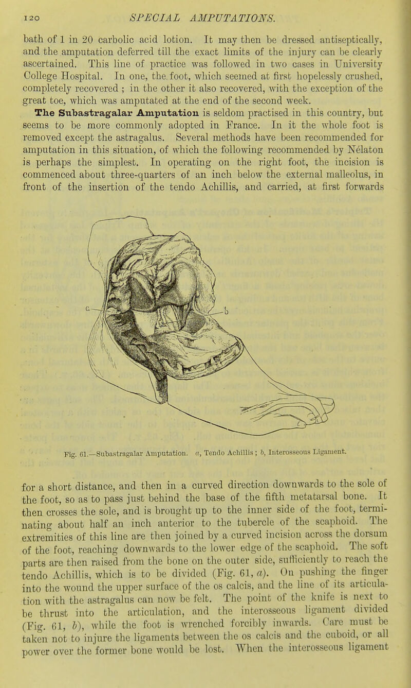 bath of 1 in 20 carbolic acid lotion. It may then be dressed antiseptically, and the amputation deferred till the exact limits of the injury can be clearly ascertained. This line of practice was followed in two cases in University College Hospital. In one, the. foot, which seemed at first hopelessly crushed, completely recovered ; in the other it also recovered, with the exception of the great toe, which was amputated at the end of the second week. The Subastragalar Amputation is seldom practised in this country, but seems to be more commonly adopted in France. In it the whole foot is removed except the astragalus. Several methods have been recommended for amputation in this situation, of which the follomng recommended by Nelaton is perhaps the simplest. In operating on the right foot, the incision is commenced about three-quarters of an inch below the external malleolus, in front of the insertion of the tendo Achillis, and carried, at first forwards for a short distance, and then in a curved direction downwards to the sole of the foot, so as to pass just behind the base of the fifth metatarsal bone. It then crosses the sole, and is brought up to the inner side of the foot, termi- nating about half an inch anterior to the tubercle of the scaphoid. The extremities of this line are then joined by a curved incision across the dorsum of the foot, reaching downwards to the lower edge of the scaphoid. The soft parts are then raised from the bone on the outer side, sufliciently to reach the tendo Achillis, which is to be divided (Fig. 61, a). On pushing the finger into the wound the upper surface of the os calcis, and the line of its articula- tion with the astragalus can now be felt. The point of the knife is next to be thrust into the articulation, and the interosseous ligament divided (Fig. 61, h), while the foot is wrenched forcibly inwards. Care must be taken not to injure the ligaments between the os calcis and the cuboid, or all power over the former bone would be lost. When the interosseous ligament