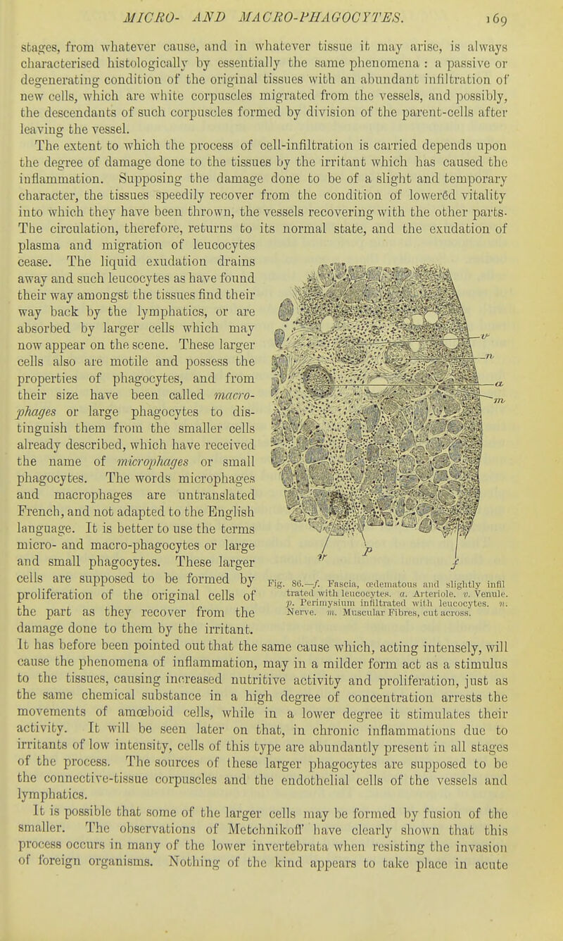 MICRO- AND iMACRO-FHAGOGYTES. stages, from whatever cause, and in wliatever tissue it may arise, is always characterised histologically by essentially the same phenomena : a passive or degenerating condition of the original tissues with an abundant inhltration of new cells, which are white corpuscles migrated from the vessels, and possibly, the descendants of such corpuscles formed by division of the parent-cells after leaving the vessel. The extent to which the process of cell-infiltration is carried depends upon the degree of damage done to the tissues by the irritant which has caused the inflammation. Supposing the damage done to be of a slight and temporary character, the tissues speedily recover from the condition of lowered vitality into which they have been thrown, the vessels recovering with the other parts- The circulation, therefore, returns to its normal state, and the exudation of plasma and migration of leucocytes cease. The liquid exudation drains away and such leucocytes as have found their way amongst the tissues find their way back by the lymphatics, or are absorbed by larger cells which may now appear on the scene. These larger cells also are motile and possess the properties of phagocytes, and from their size have been called macro- phages or large phagocytes to dis- tinguish them from the smaller cells already described, which have received the name of mic7'(yphages or small phagocytes. The words microphages and macrophages are untranslated French, and not adapted to the English language. It is better to use the terms micro- and macro-phagocytes or large and small phagocytes. These larger cells are supposed to be formed by proliferation of the original cells of the part as they recover from the damage done to them by the irritant. It has before been pointed out that the same cause which, acting intensely, will cause the phenomena of inflammation, may in a milder form act as a stimulus to the tissues, causing increased nutritive activity and proliferation, just as the same chemical substance in a high degree of concentration arrests the movements of amoeboid cells, while in a lower degree it stimulates their activity. It will be seen later on that, in chronic inflammations due to irritants of low intensity, cells of this type are abundantly present in all stages of the process. The sources of these larger i)hagocytes are supposed to be the connective-tissue corpuscles and the endothelial cells of the A-essels and lymphatics. It is possible that some of the larger cells nuxy be formed by fusion of the smaller. The observations of Metchnikofl' have clearly shown that this process occurs in many of the lower invertebrata when resisting the invasion of foreign organisms. Nothing of the kind appears to take place in acute Fia / SO.—/. Fascia, cedeiiiatoiis and slightly iiifil trateil with leucocytes, a. Arteriole, v. Venule. p. Perimysium inliltrated witli leucocytes, n. Nerve. in. Muscular Fibres, cut across.