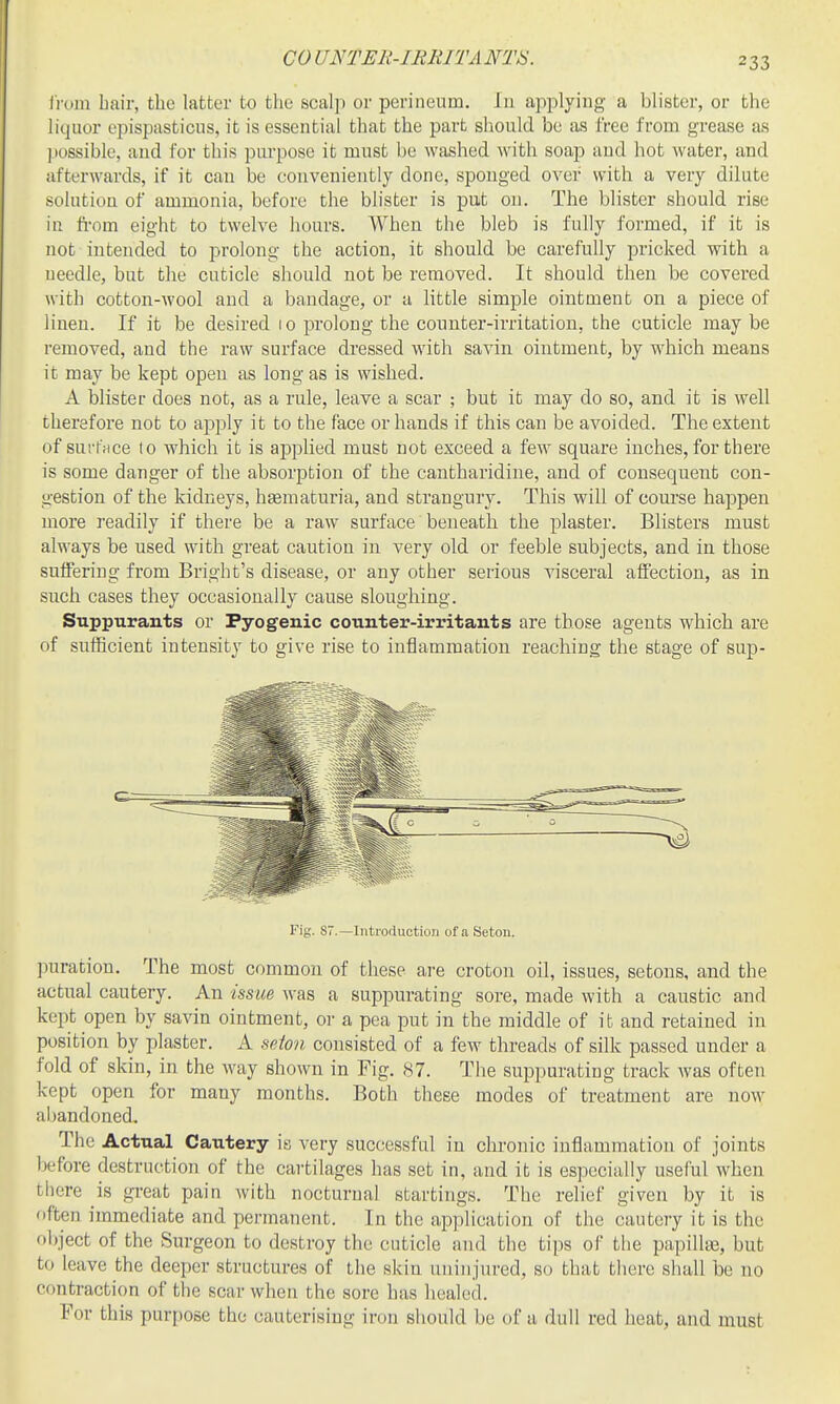CO UNTEli-IRRITANTS. iruin bail', the latter to the scalp or perineum. In applying a blister, or the liquor epispasticus, it is essential that the part should be as free from grease as possible, and for this purpose it must be washed with soap and hot Avater, and afterwards, if it can be conveniently done, sponged over with a very dilute solution of ammonia, before the blister is put on. The blister should rise in ft-om eight to twelve hours. When the bleb is fully formed, if it is not intended to prolong the action, it should be carefully pricked with a ueedlc, but the cuticle should not be removed. It should then be covered with cotton-Avool and a bandage, or a little simple ointment on a piece of linen. If it be desired 10 prolong the counter-irritation, the cuticle maybe removed, and the raw surface dressed with savin ointment, by which means it may be kept open as long as is wished. A blister does not, as a rule, leave a scar ; but it may do so, and it is well therefore not to apply it to the face or hands if this can be avoided. The extent of surtVice to which it is applied must not exceed a few square inches, for there is some danger of the absorption of the cantharidine, and of consequent con- gestion of the kidneys, h£ematuria, and strangury. This will of course happen more readily if there be a raw surface beneath the plaster. Blisters must always be used with great caution in very old or feeble subjects, and in those sulfering from Bright's disease, or any other serious visceral afiection, as in such cases they occasionally cause sloughing. Suppurants or Pyogenic counter-irritants are those agents which are of sufficient intensity to give rise to inflammation reaching the stage of sup- Fig. 87.—Introduction of a Setoii. puration. The most common of these are croton oil, issues, setons, and the actual cautery. An issue was a suppurating sore, made with a caustic and kept open by savin ointment, or a pea put in the middle of it and retained in position by plaster. A sdon consisted of a few threads of silk passed under a fold of skin, in the way shown in Fig. 87. Tlie suppurating track was often kept open for many months. Both tliese modes of treatment are now abandoned. The Actual Cautery is very successful in chronic inflammation of joints before destruction of the cai-tilages has set in, and it is especially useful when there is great pain with nocturnal startings. The relief given by it is often immediate and permanent. In the application of the cautery it is the object of the Surgeon to destroy the cuticle and the tips of the papillte, but to leave the deeper structures of the skin uninjured, so that there sliall be no contraction of the scar when the sore has liealed. For this purpose the cauterising iron should be of a dull red heat, and must
