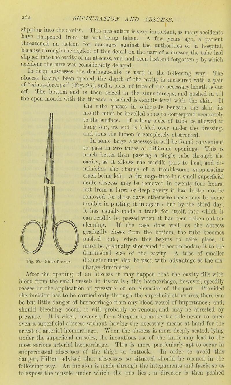 slipping into the cavity. This precaution is very important, as many accidents have happened from its not being taken. A few years ago,'a patient threatened an action for damages against the authorities of a hospital, because through the neglect of this detail on the part of a dresser, the tube had slipped into the cavity of an abscess, and had been lost and forgotten ; by which accident tlie cure was considerably delayed. In deep abscesses the drainage-tube is used in the following way. The abscess having been opened, the depth of the cavity is measured with a pair of sinus-forceps (Fig. 9;j), and a piece of tube of the necessary length is cut off. The bottom end is then seized in the sinus-forceps, and pushed in till the open mouth with the threads attached is exactly level with the skin. If the tube passes in obliquely beneath the skin, its mouth must be bevelled so as to correspond accurately to the surface. If a long piece of tube be allowed to hang out, its end is folded over under the dressing, and thus the lumen is completely obstructed. In some large abscesses it will be found convenient to pass in iwo tubes at different openings. This is much better than passing a single tube through the cavity, as it allows the middle part to heal, and di- minishes the chance of a troublesome suppurating track being left. A drainage-tube in a small superficial acute abscess may be removed in twenty-four hours, but from a large or deep cavity it had better not be removed for three days, otherwise there may be some trouble in putting it in again ; but by the third day, it has usually made a track for itself, into which it can readily be passed when it has been taken out for cleaning. If the case does well, as the abscess gradually closes from the bottom, the tube becomes pushed out; when this begins to take place, it must be gradually shortened to accommodate it to the diminished size of the cavity. A tube of smaller Fig. 05.—Sinus forceps. diameter may also be used with advantage as the dis- charge diminishes. After the opening of an abscess it may happen that the cavity fills with blood from the small vessels in its walls ; this hremorrhage, however, speedily ceases on the application of pressure or on elevation of the part. Provided the incision has to be carried only through the superficial structures, there can be but little danger of ha3morrhage from any blood-vessel of importance; and, should bleeding occur, it will probably be venous, and may be arrested by pressure. It is wiser, however, for a Surgeon to make it a rule never to open even a superficial abscess without having the necessary means at hand for the arrest of arterial haamorrhage. When the abscess is more deeply seated, lying under the superficial muscles, the incautious use of the knife may lead to the most serious arterial hasniorrliagc. This is more particularly apt to occur in subperiosteal abscesses of the thigh or buttock. In order to avoid this danger, Hilton advised that abscesses so situated sliould be opened in the following way. An incision is made through the integuments and fascia so as to expose the muscle under which the pus lies ; a director is then pushed
