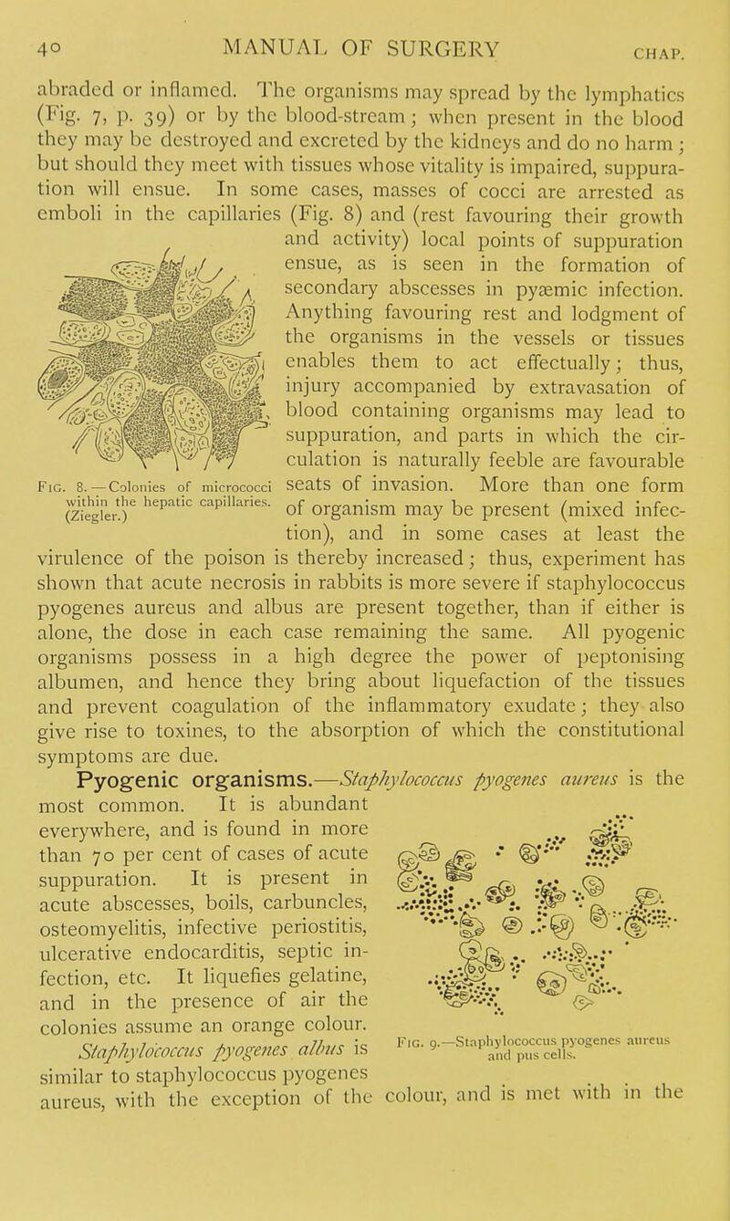 abraded or inflamed. The organisms may spread by the lymphatics (Fig- 7> P- 39) or by the blood-stream; when present in the blood they may be destroyed and excreted by the kidneys and do no harm ; but should they meet with tissues whose vitality is impaired, suppura- tion will ensue. In some cases, masses of cocci are arrested as emboli in the capillaries (Fig. 8) and (rest favouring their growth and activity) local points of suppuration ^^-^-M'^^.ly , ensue, as is seen in the formation of '^^^^^^^^^x^'^y A secondary abscesses in pyaemic infection. Fig. 8. — Colonies of micrococci within tlie hepatic capillaries. (Ziegler.) blood containing organisms may lead to suppuration, and parts in which the cir- culation is naturally feeble are favourable seats of invasion. More than one form of organism may be present (mixed infec- tion), and in some cases at least the virulence of the poison is thereby increased; thus, experiment has shown that acute necrosis in rabbits is more severe if staphylococcus pyogenes aureus and albus are present together, than if either is alone, the dose in each case remaining the same. All pyogenic organisms possess in a high degree the power of peptonising albumen, and hence they bring about liquefaction of the tissues and prevent coagulation of the inflammatory exudate; they also give rise to toxines, to the absorption of which the constitutional symptoms are due. Pyogenic organisms.—Staphylococcus pyogenes aureus is the most common. It is abundant • • s everywhere, and is found in more than 70 per cent of cases of acute suppuration. It is present in acute abscesses, boils, carbuncles, osteomyelitis, infective periostitis, ulcerative endocarditis, septic in- fection, etc. It liquefies gelatine, and in the presence of air the colonies assume an orange colour. Staphylococcus pyogeties albus is similar to staphylococcus pyogenes aureus, with the exception of the colour, and is met with in the Fig. 9.—Staphylococcus pyogenes aureus and pus cells.