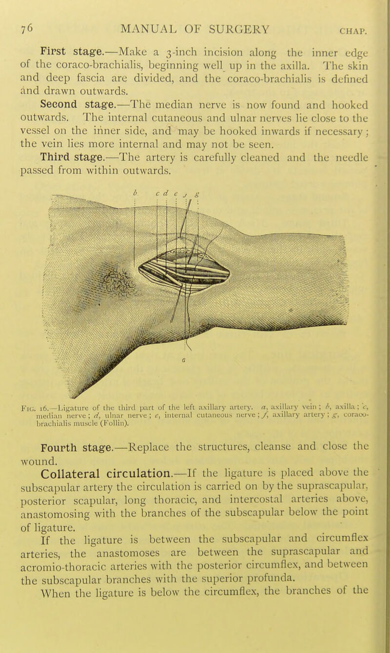 First stage.—Make a 3-inch incision along the inner edge of the coraco-brachiahs, beginning well up in the axilla. The skin and deep fascia are divided, and the coraco-brachialis is defined and drawn outwards. Second stage.—The median nerve is now found and hooked outwards. The internal cutaneous and ulnar nerves lie close to the vessel on the iriner side, and may be hooked inwards if necessary; the vein lies more internal and may not be seen. Third stage.—The artery is carefully cleaned and the needle passed from within outwards. b c (i c J g Fu;. i6.~Ligature of the lliird p.irt uf tlie left .nxillary artery, a, axillary vein ; />, axilla ; c, median nerve; d, ulnar nerve; c, internal cutaneous nerve ;y; a.\illary artery;^', coraoo- brachialis muscle (FoUin). Fourth stage.—Replace the structures, cleanse and close the wound. Collateral circulation.—If the ligature is placed above the subscapular artery the circulation is carried on by the suprascapular, posterior scapular, long thoracic, and intercostal arteries above, anastomosing with the branches of the subscapular below the point of ligature. If the ligature is between the subscapular and circumflex arteries, the anastomoses are between the suprascapular and acromio-thoracic arteries with the posterior circumflex, and between the subscapular branches with the superior profunda. When the ligature is below the circumflex, the branches of the