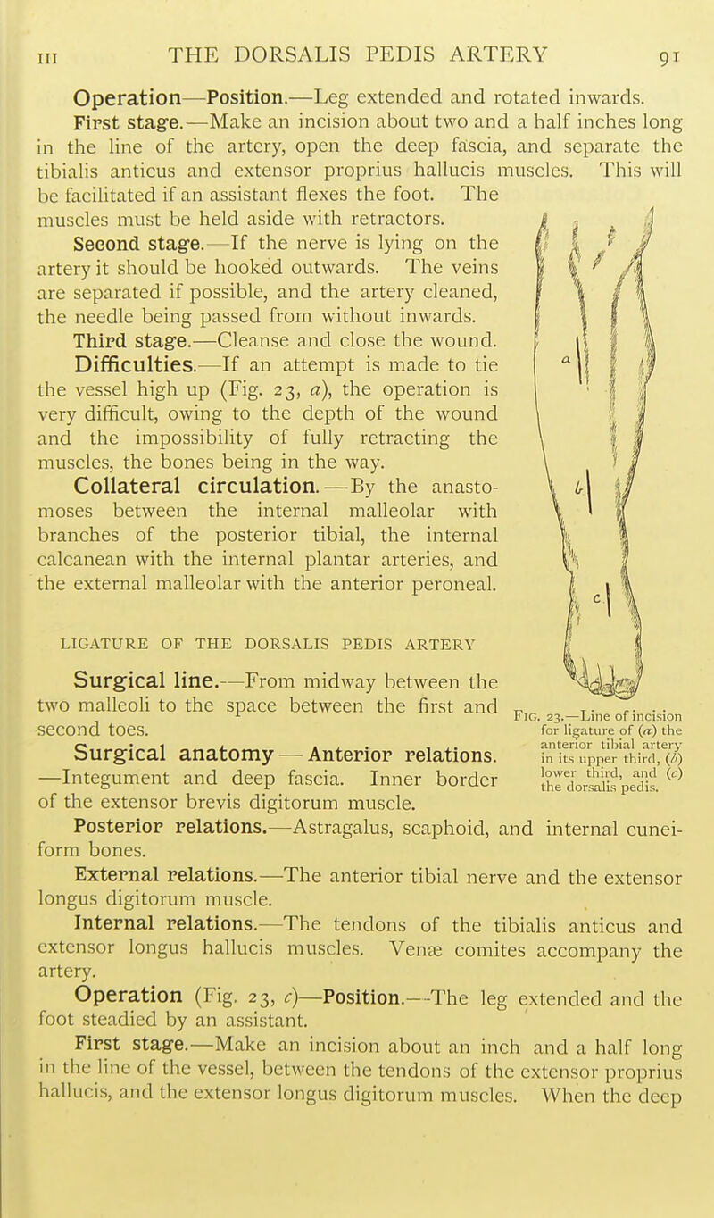 Operation—Position.—Leg extended and rotated inwards. First stage.—Make an incision about two and a half inches long in the line of the artery, open the deep fo;scia, and separate the tibialis anticus and extensor proprius hallucis muscles. This will be facilitated if an assistant flexes the foot. The muscles must be held aside with retractors. Second stage.—If the nerve is lying on the artery it should be hooked outwards. The veins are separated if possible, and the artery cleaned, the needle being passed from without inwards. Third stage.—Cleanse and close the wound. Difficulties.—If an attempt is made to tie the vessel high up (Fig. 23, a), the operation is very difificult, owing to the depth of the wound and the impossibility of fully retracting the muscles, the bones being in the way. Collateral circulation.—By the anasto- moses between the internal malleolar with branches of the posterior tibial, the internal calcanean with the internal plantar arteries, and the external malleolar with the anterior peroneal. LIGATURE OF THE DORSALIS PEDIS ARTERY Surgical line.—From midway between the two malleoli to the space between the first and second toes. Surgical anatomy — Anterior relations. —Integument and deep fascia. Inner border of the extensor brevis digitorum muscle. Posterior relations.—Astragalus, scaphoid, and internal cunei- form bones. External relations.—The anterior tibial nerve and the extensor longus digitorum muscle. Internal relations.—The tendons of the tibialis anticus and extensor longus hallucis muscles. Vente comites accompany the artery. Operation (Fig. 23, c)—Position.—The leg extended and the foot steadied by an assistant. First stage.—Make an incision about an inch and a half long in the line of the vessel, between the tendons of the extensor proprius halluci-s, and the extensor longus digitorum muscles. When the deep Fig. 23.—Line of incision for ligature of («) the anterior tiljial arterj' in its upper third, (/') lower third, and (c) the dorsalis pedis.